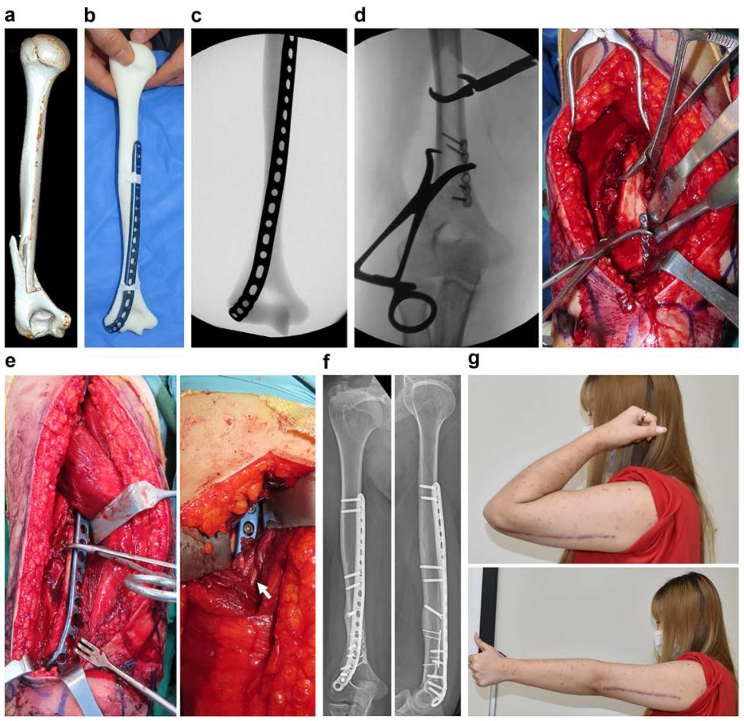 Jpm 13 01145 g004 Jpm 13 01145 g004