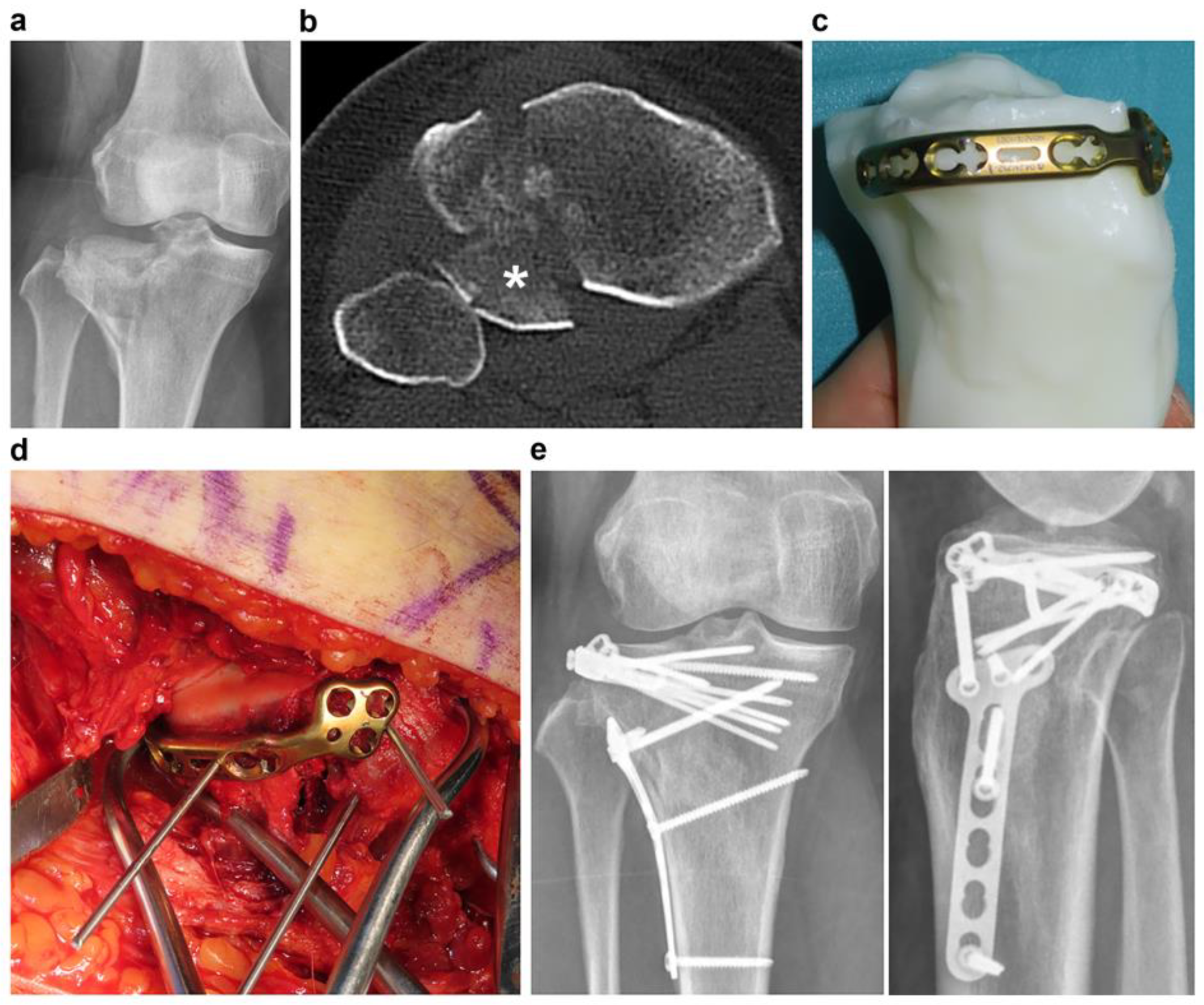 Jpm 13 01145 g005 Jpm 13 01145 g005
