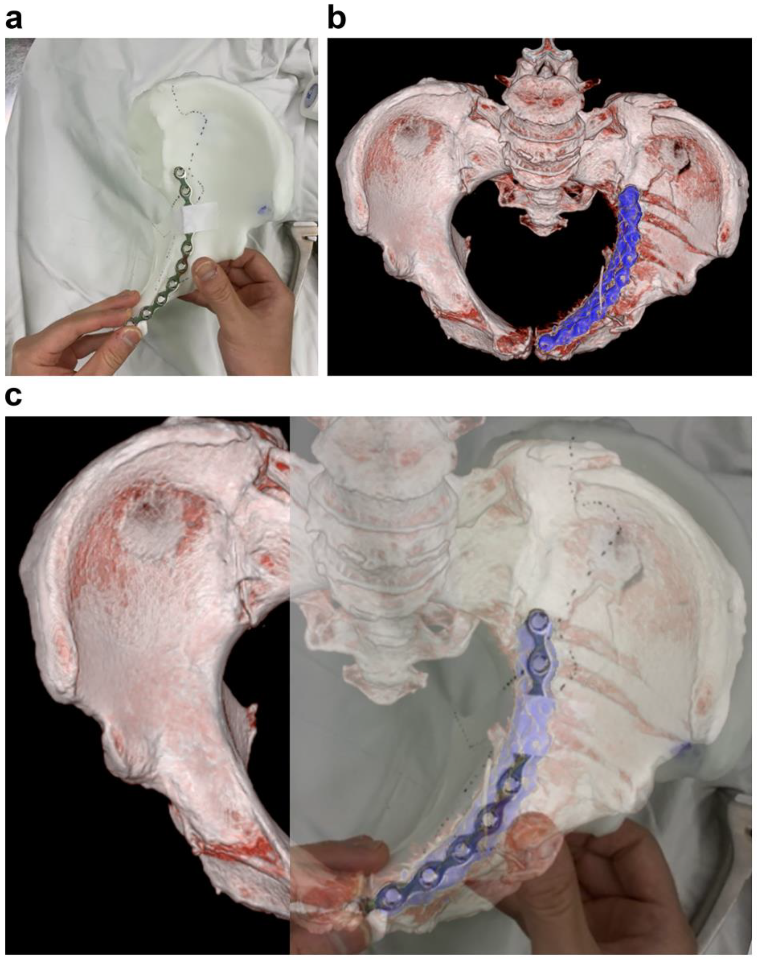 Jpm 13 01145 g006 Jpm 13 01145 g006