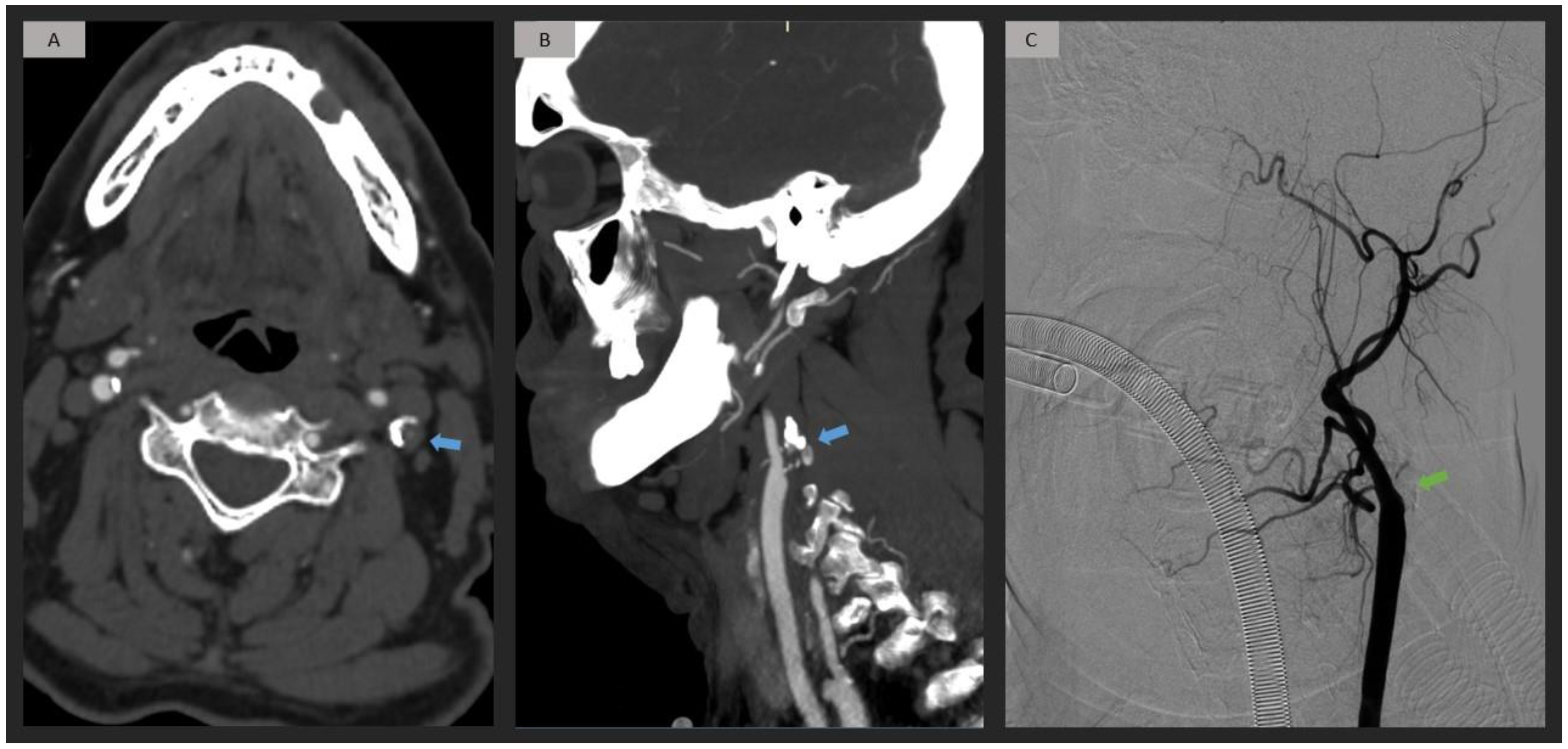 Jpm 13 01169 g003 Jpm 13 01169 g003