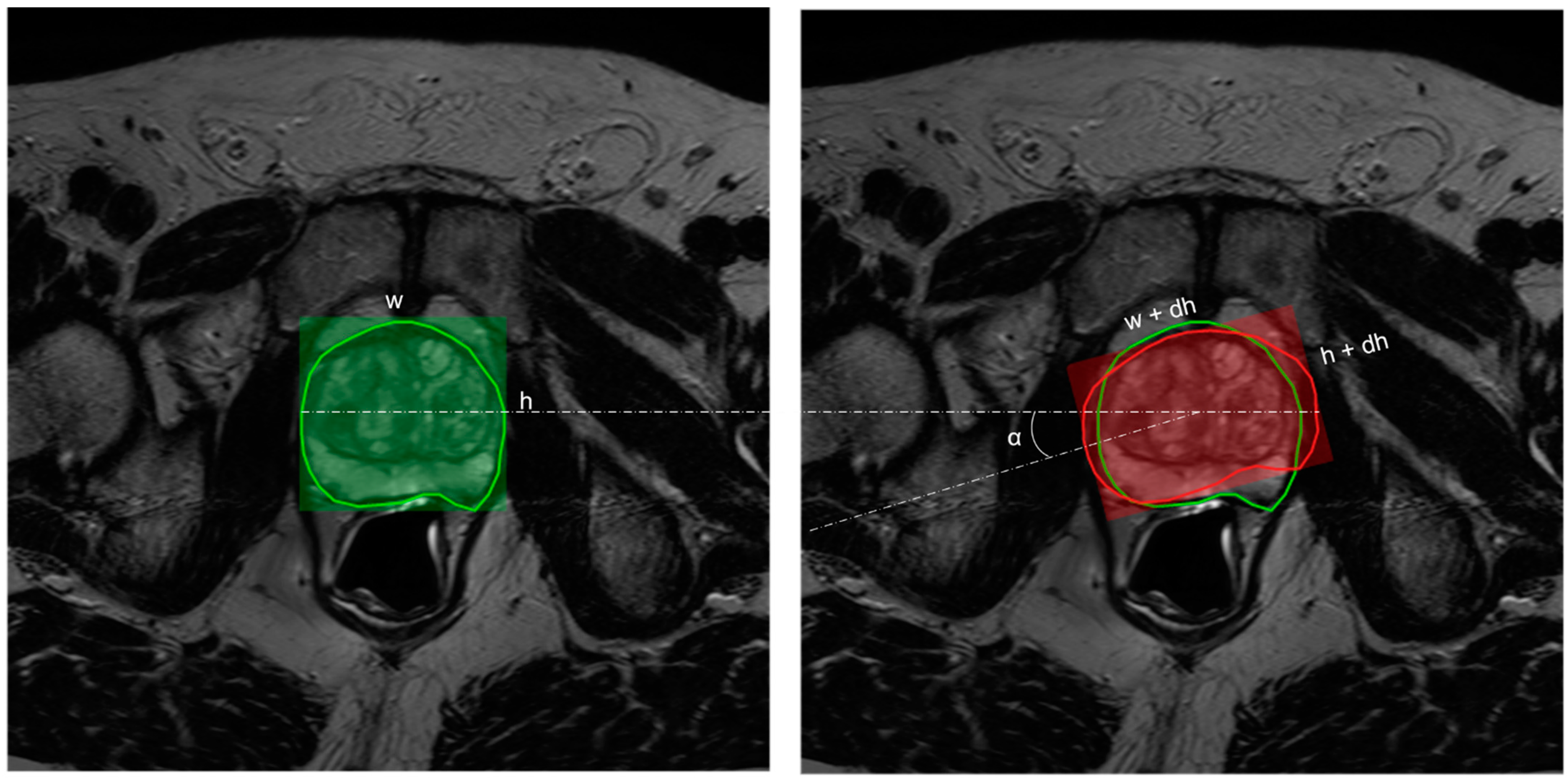 Jpm 13 01172 g002 Jpm 13 01172 g002