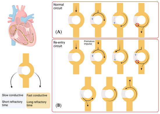 In Vitro Models for Improved Therapeutic Interventions in Atrial