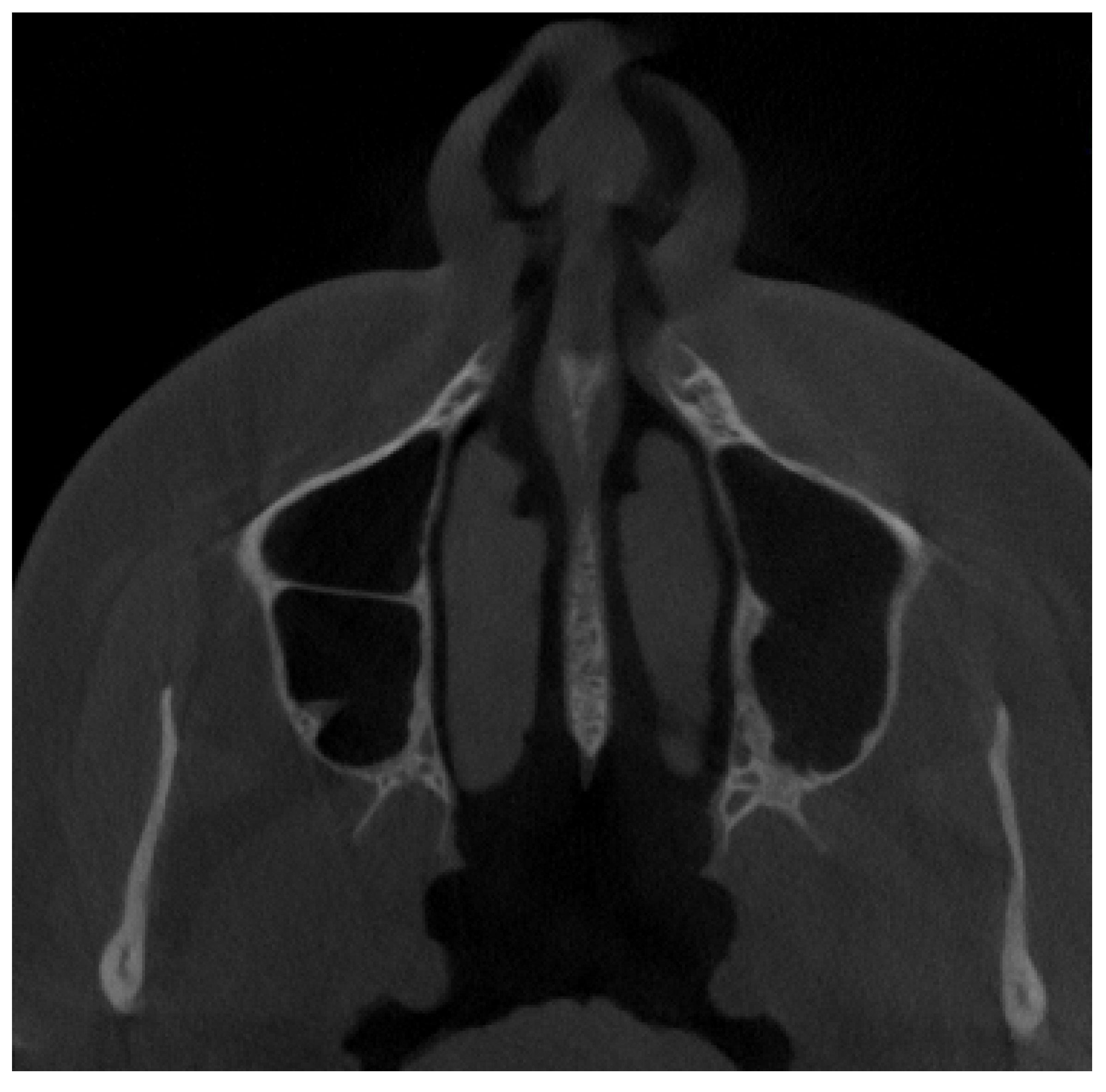 Jpm 13 01258 g004 Jpm 13 01258 g004