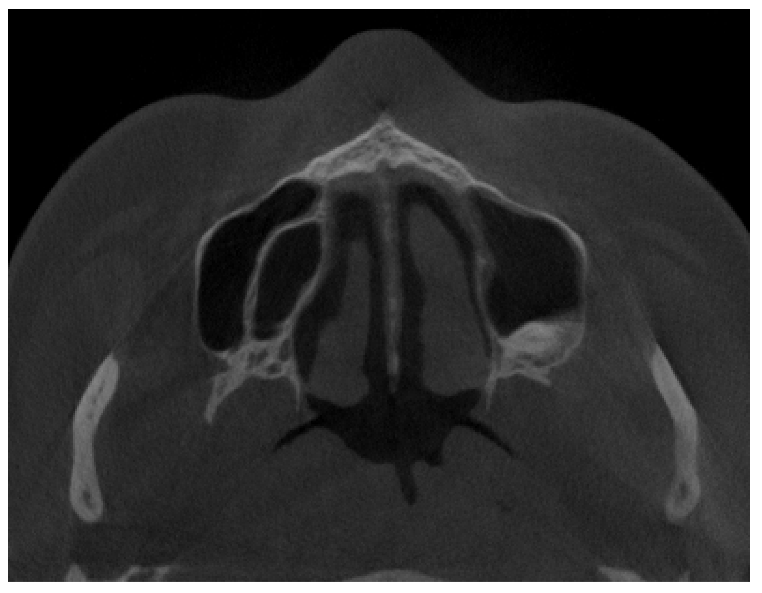 Jpm 13 01258 g006 Jpm 13 01258 g006