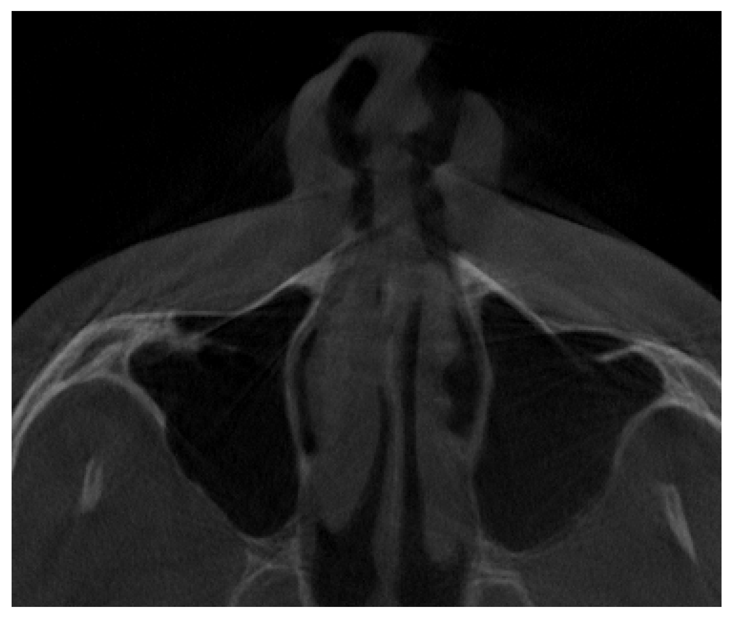 Jpm 13 01258 g008 Jpm 13 01258 g008