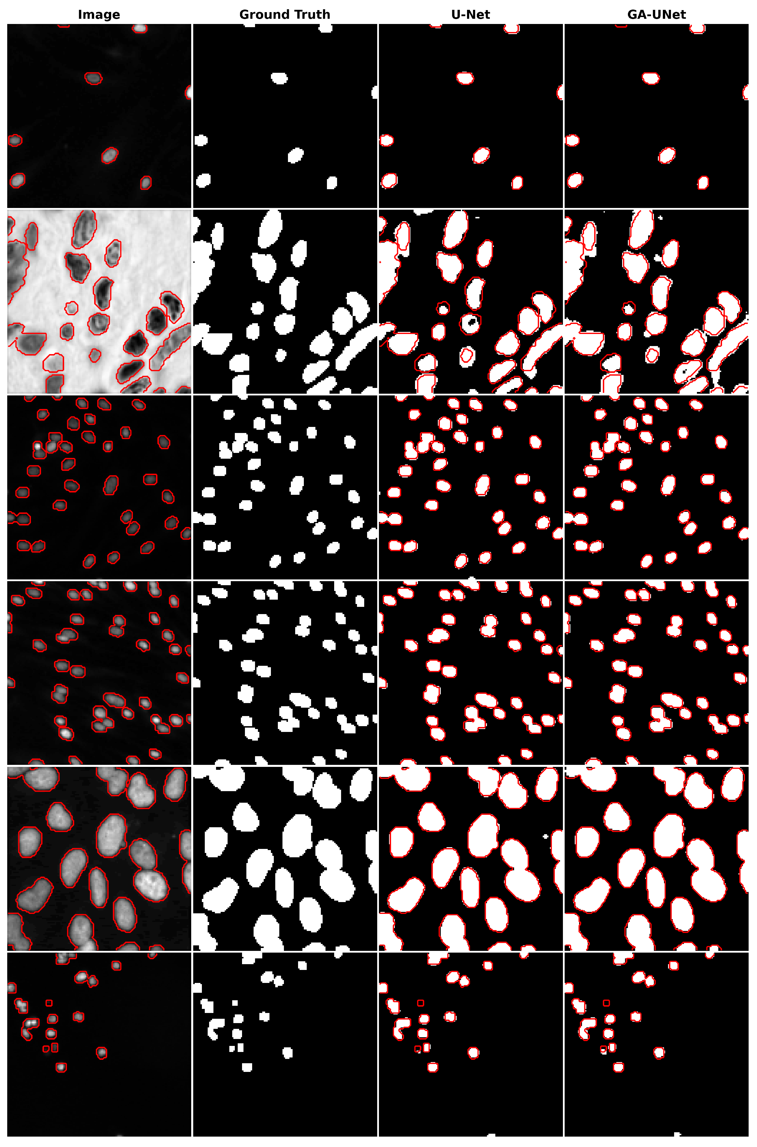JPM | Free Full-Text | Medical Image Segmentation Using Automatic ...