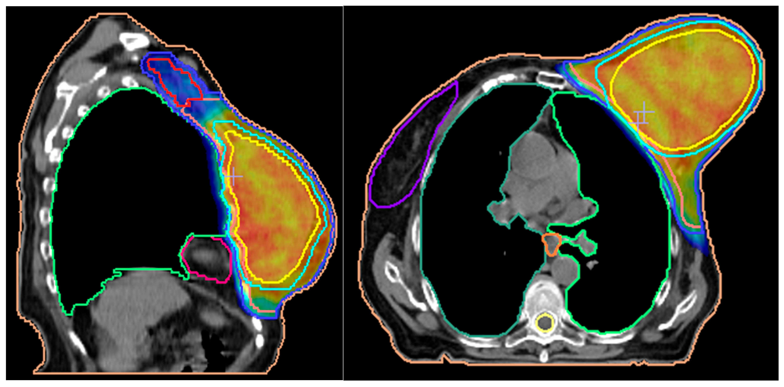 Jpm 13 01451 g007 Jpm 13 01451 g007