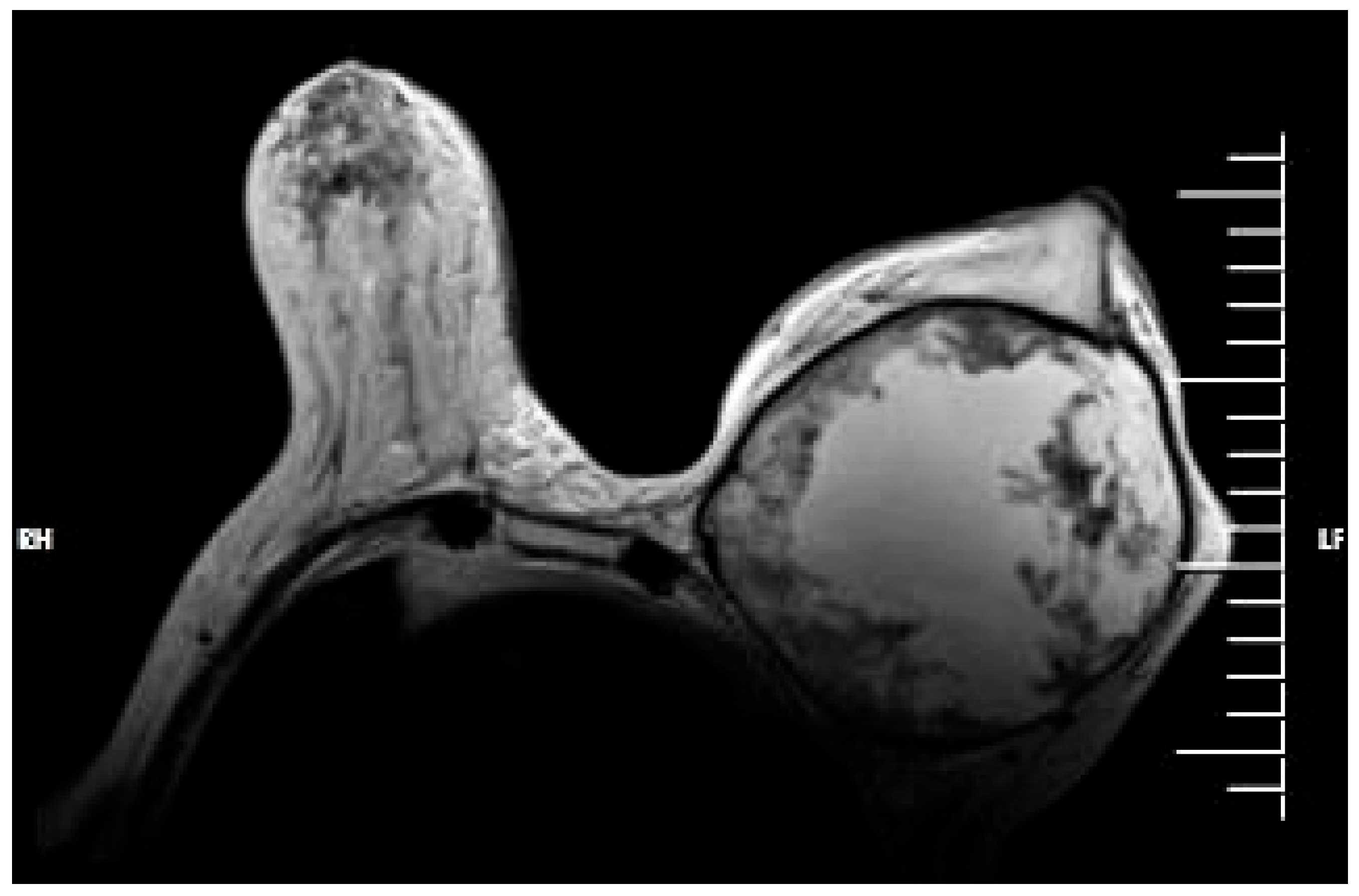 Jpm 13 01451 g008 Jpm 13 01451 g008