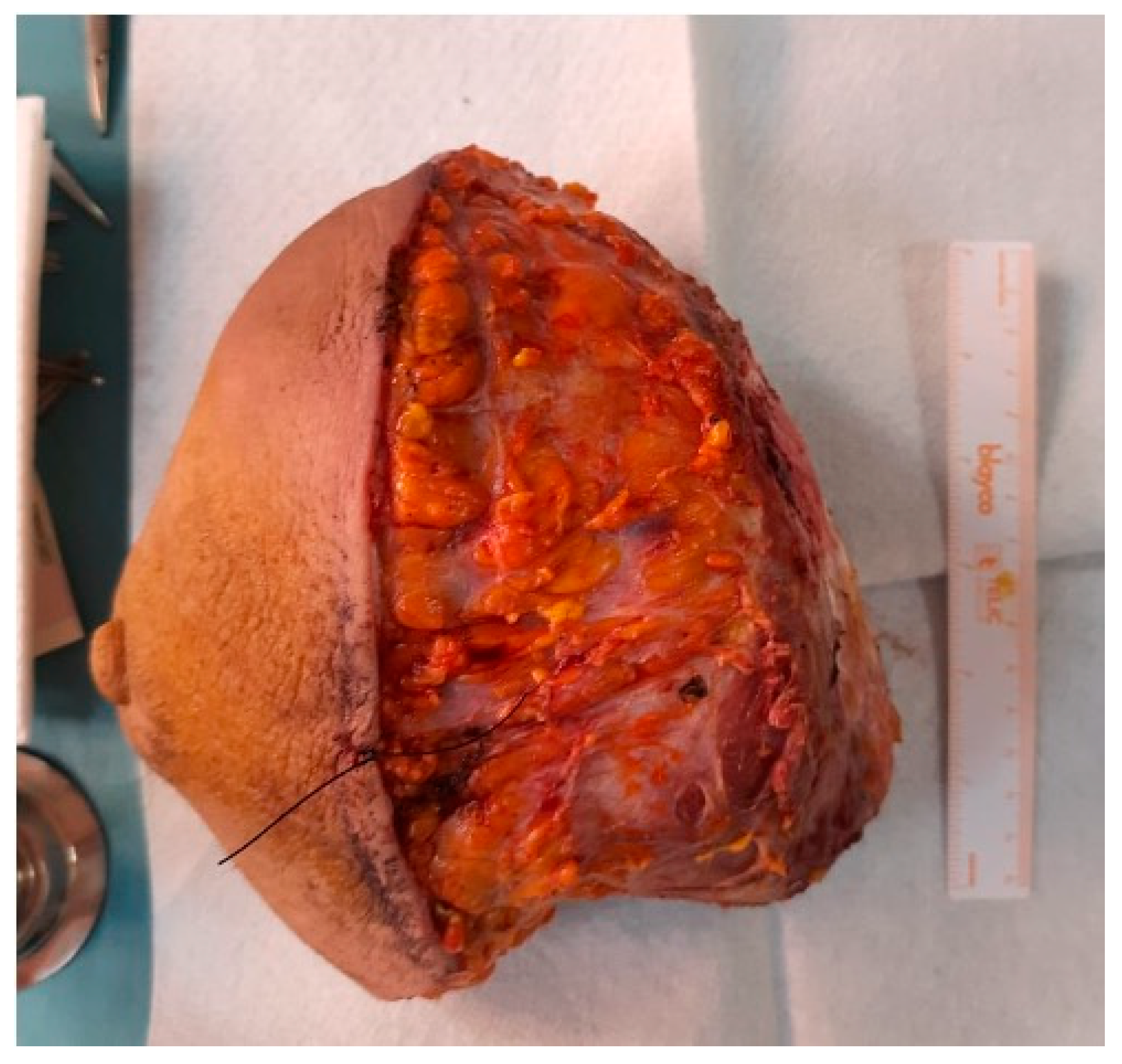 Jpm 13 01451 g009 Jpm 13 01451 g009