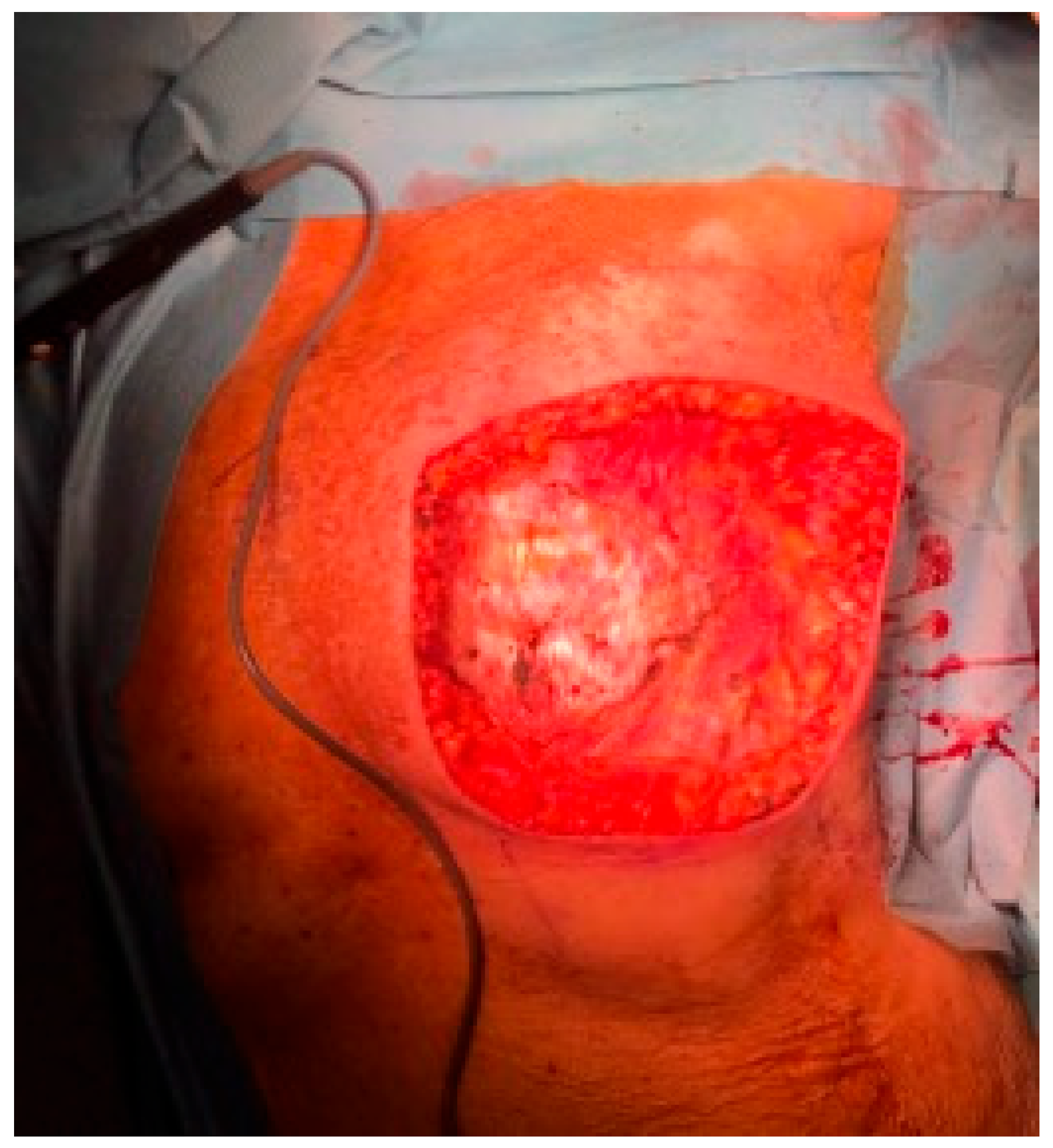 Jpm 13 01451 g010 Jpm 13 01451 g010