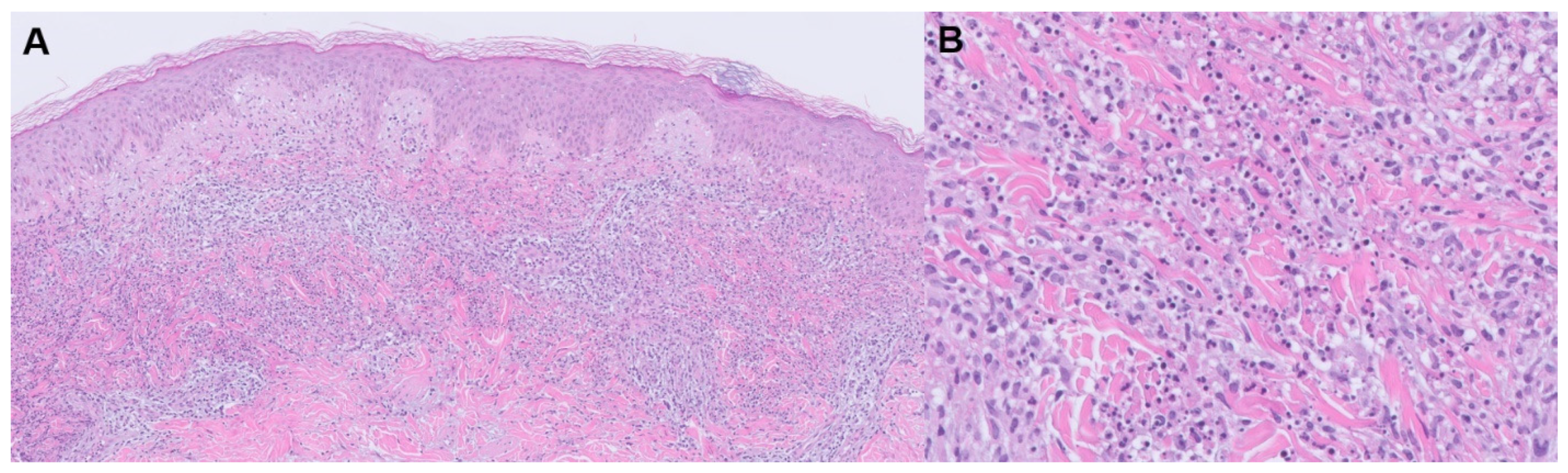 Jpm 13 01479 g004 Jpm 13 01479 g004