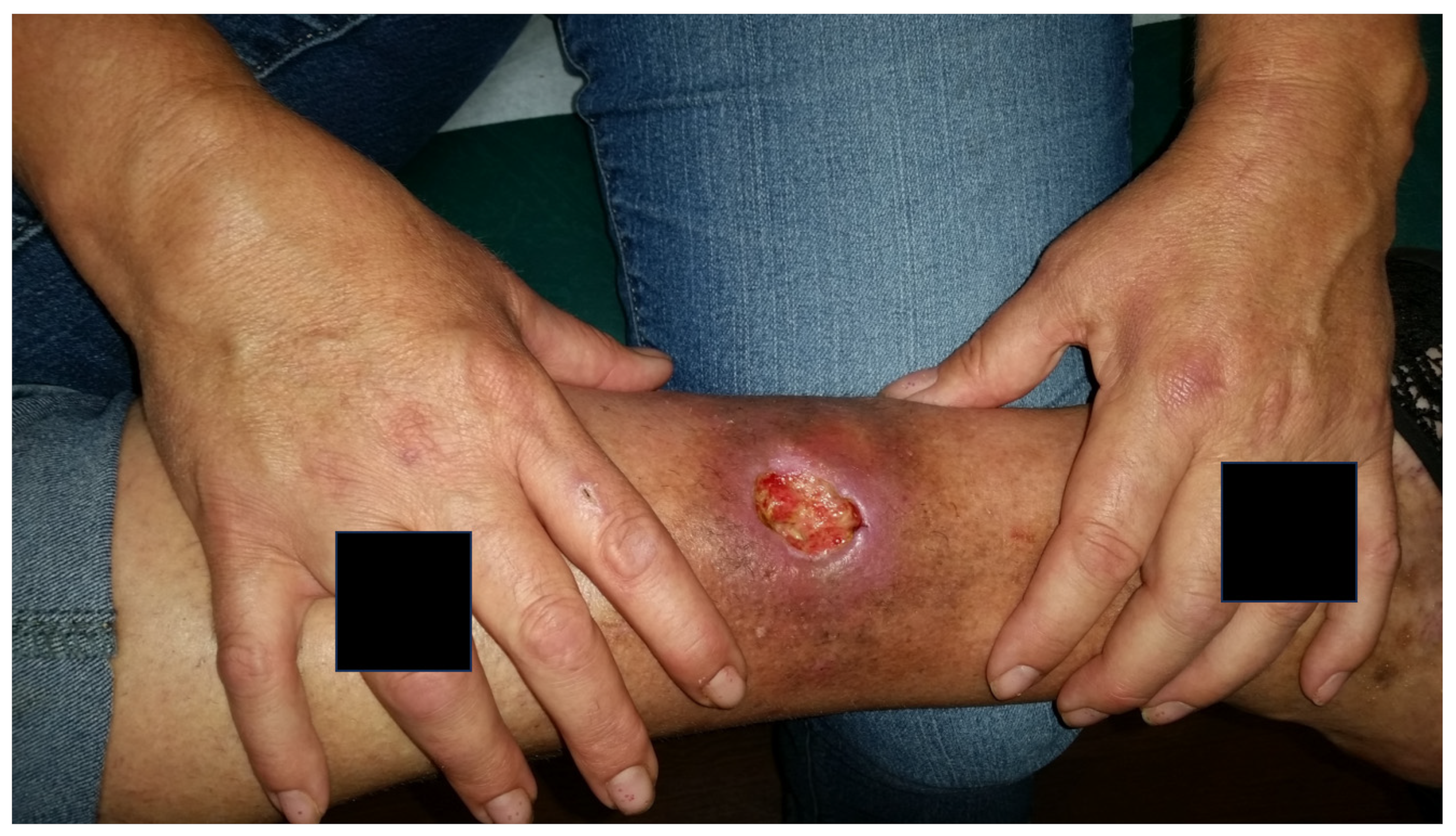 Jpm 13 01479 g009 Jpm 13 01479 g009