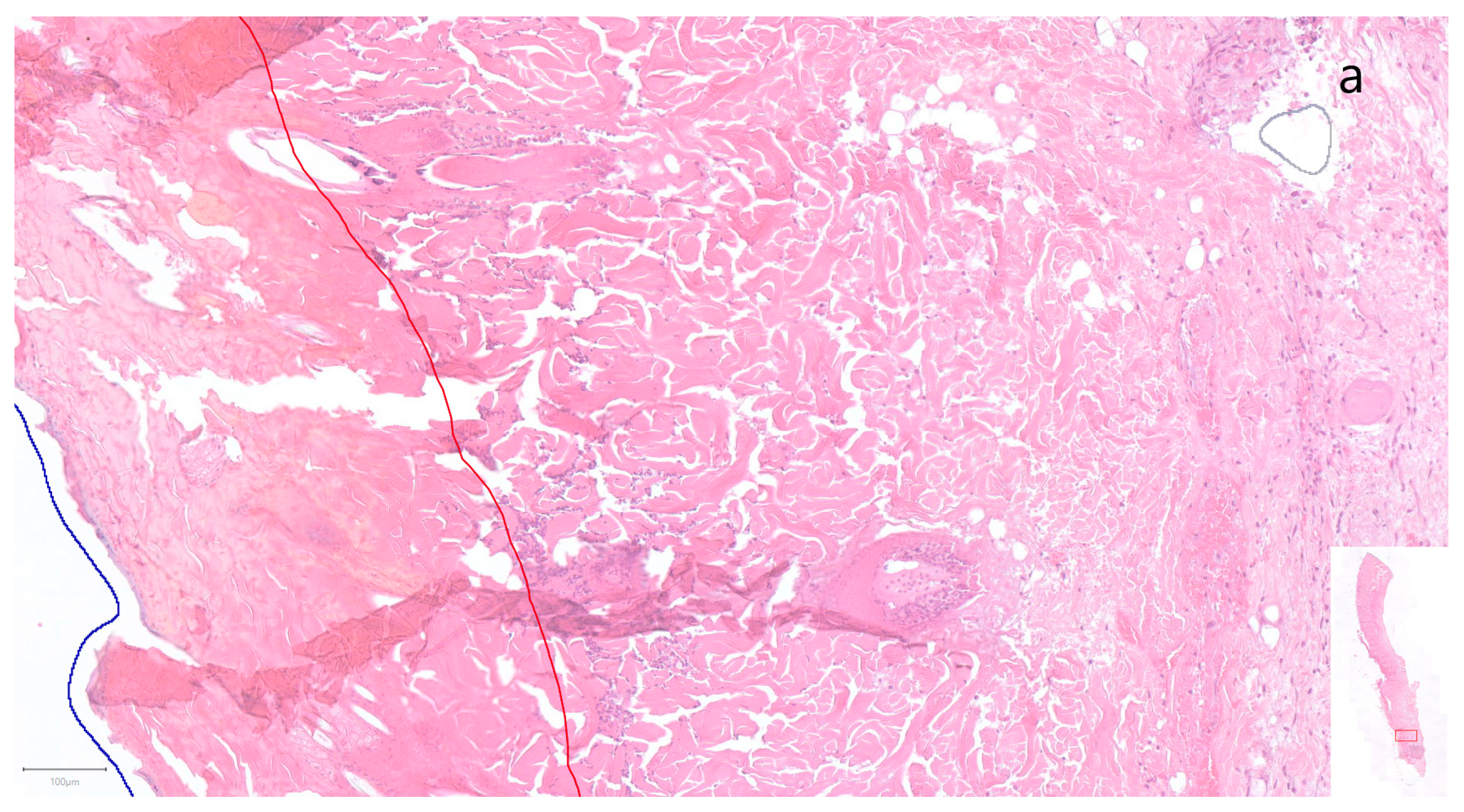 Jpm 13 01514 g003a Jpm 13 01514 g003a