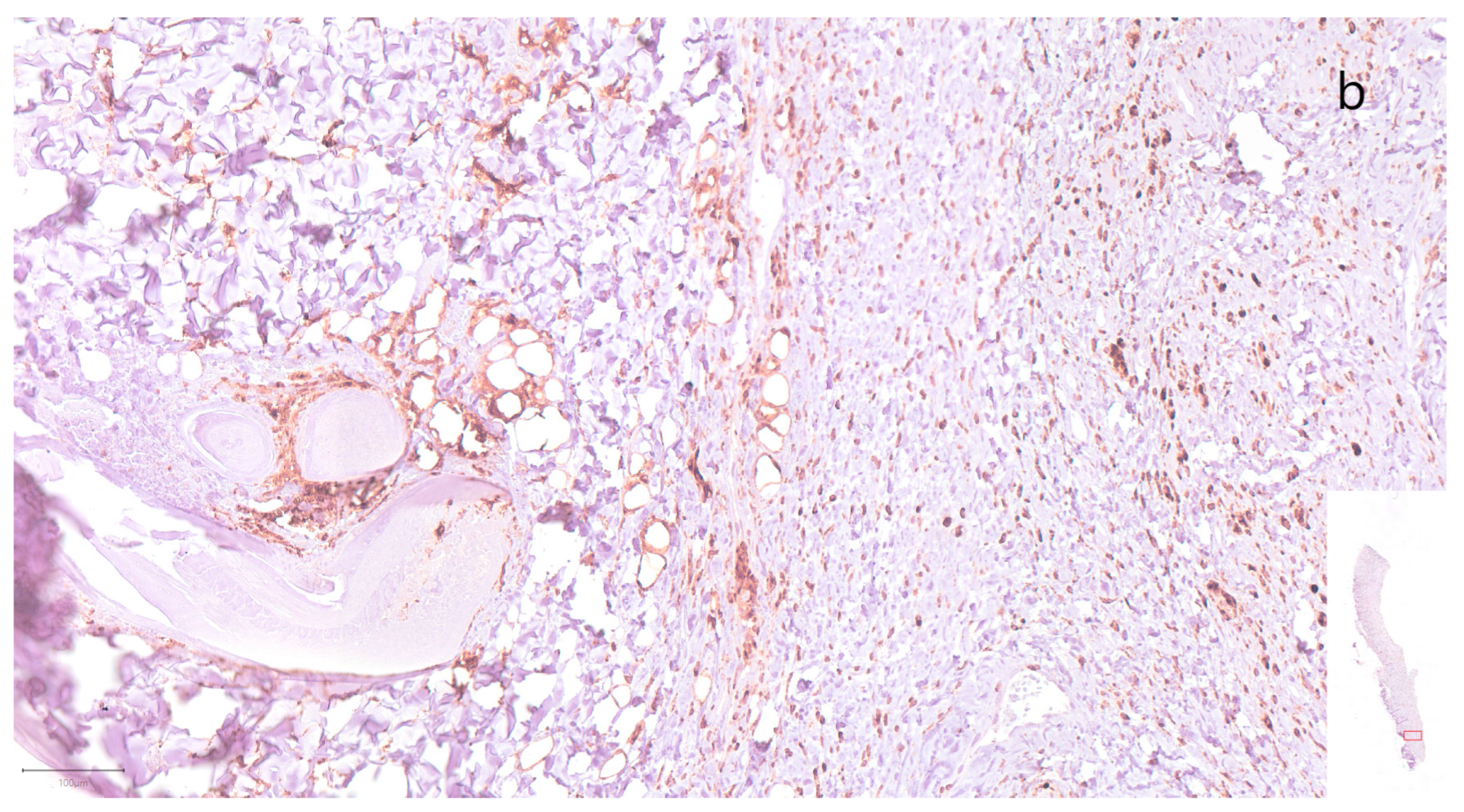 Jpm 13 01514 g003b Jpm 13 01514 g003b