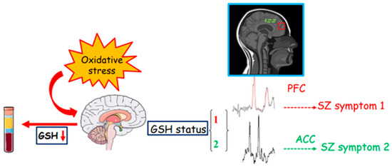 Schizophrenia and Glutathione: A Challenging Story