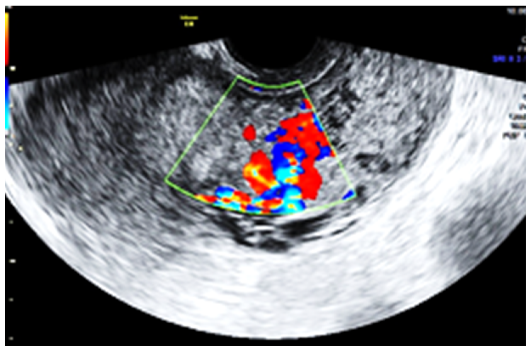 Jpm 13 01563 g003 Jpm 13 01563 g003