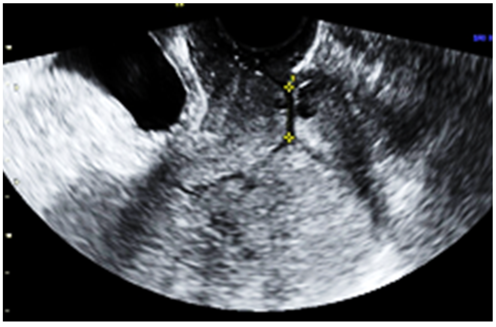 Jpm 13 01563 g004 Jpm 13 01563 g004