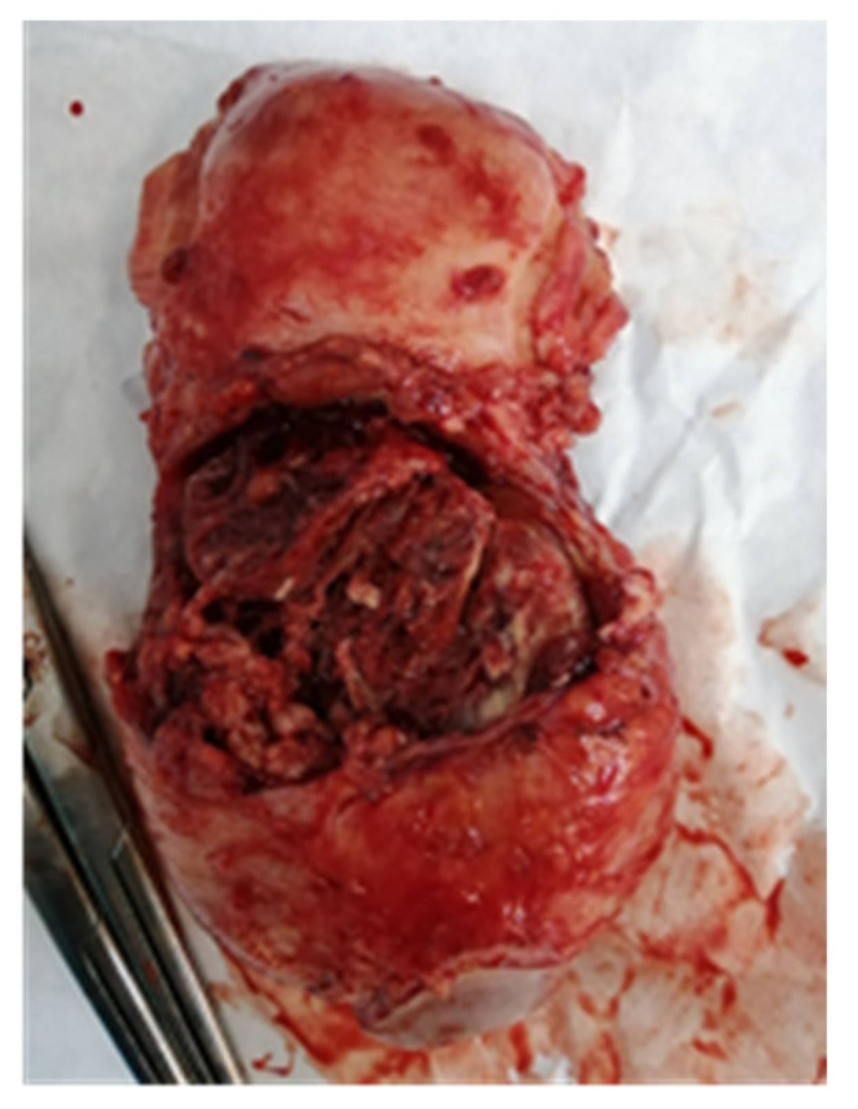 Jpm 13 01563 g006 Jpm 13 01563 g006