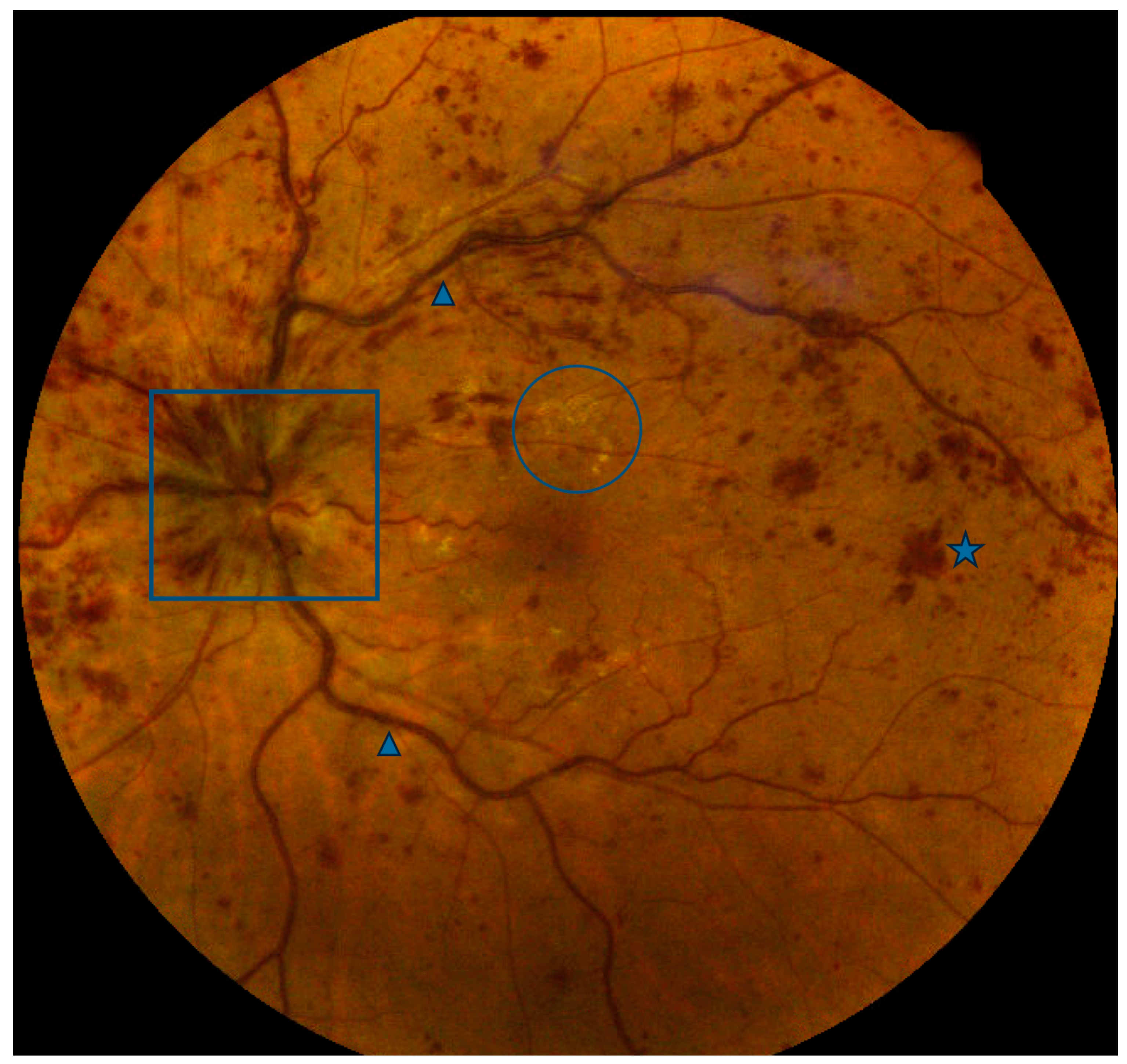 PDF] Multivariate cube integrated retinal variable to visually