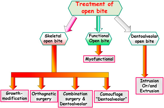 JPM | Free Full-Text | Anterior Open Bite Malocclusion: From Clinical ...