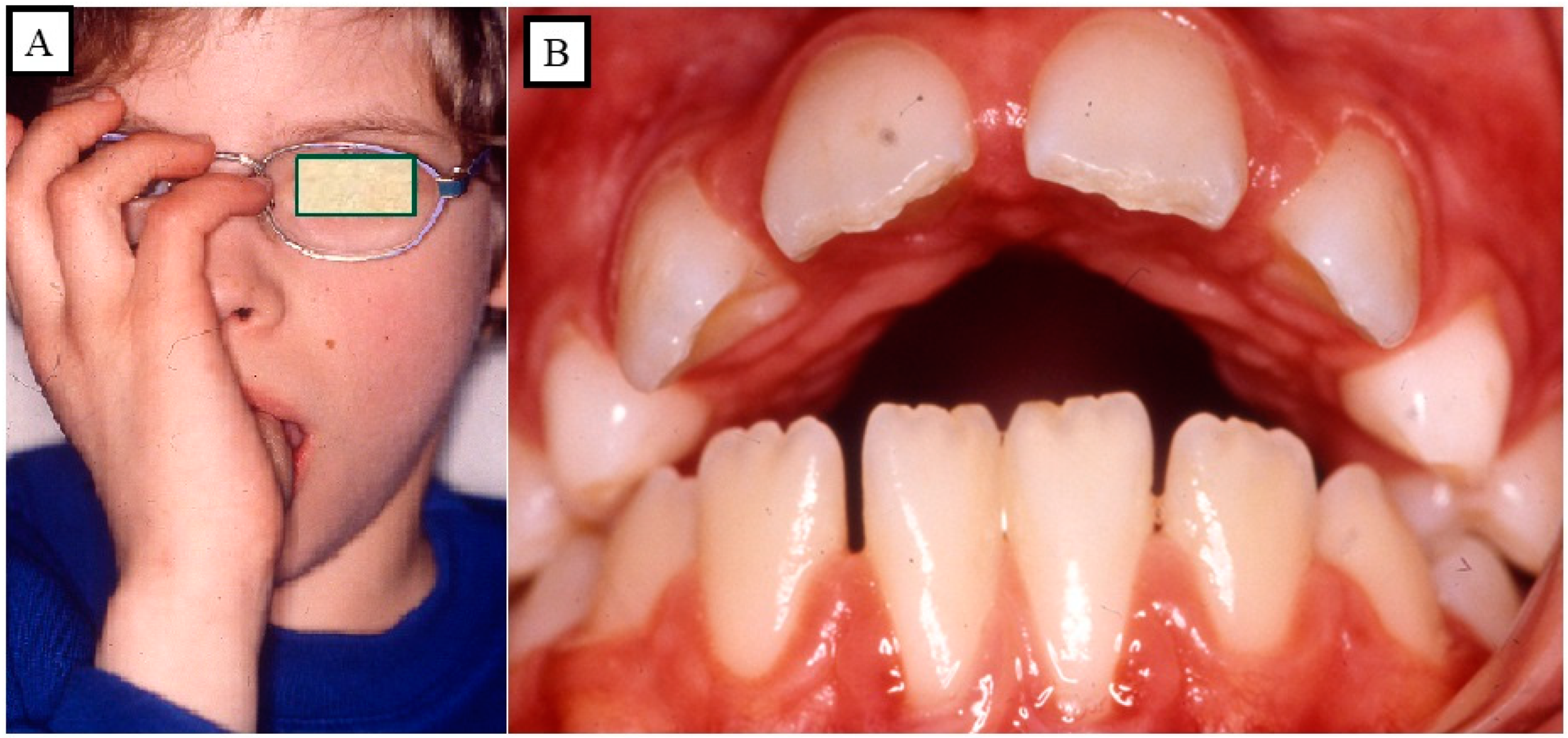 Jpm 13 01617 g011 Jpm 13 01617 g011