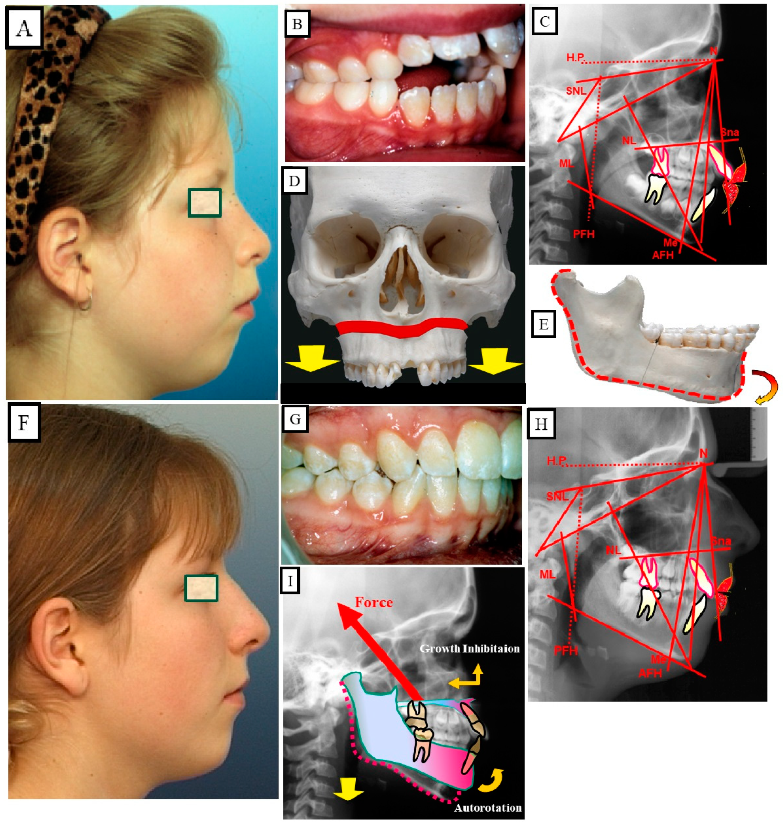 Jpm 13 01617 g014 Jpm 13 01617 g014