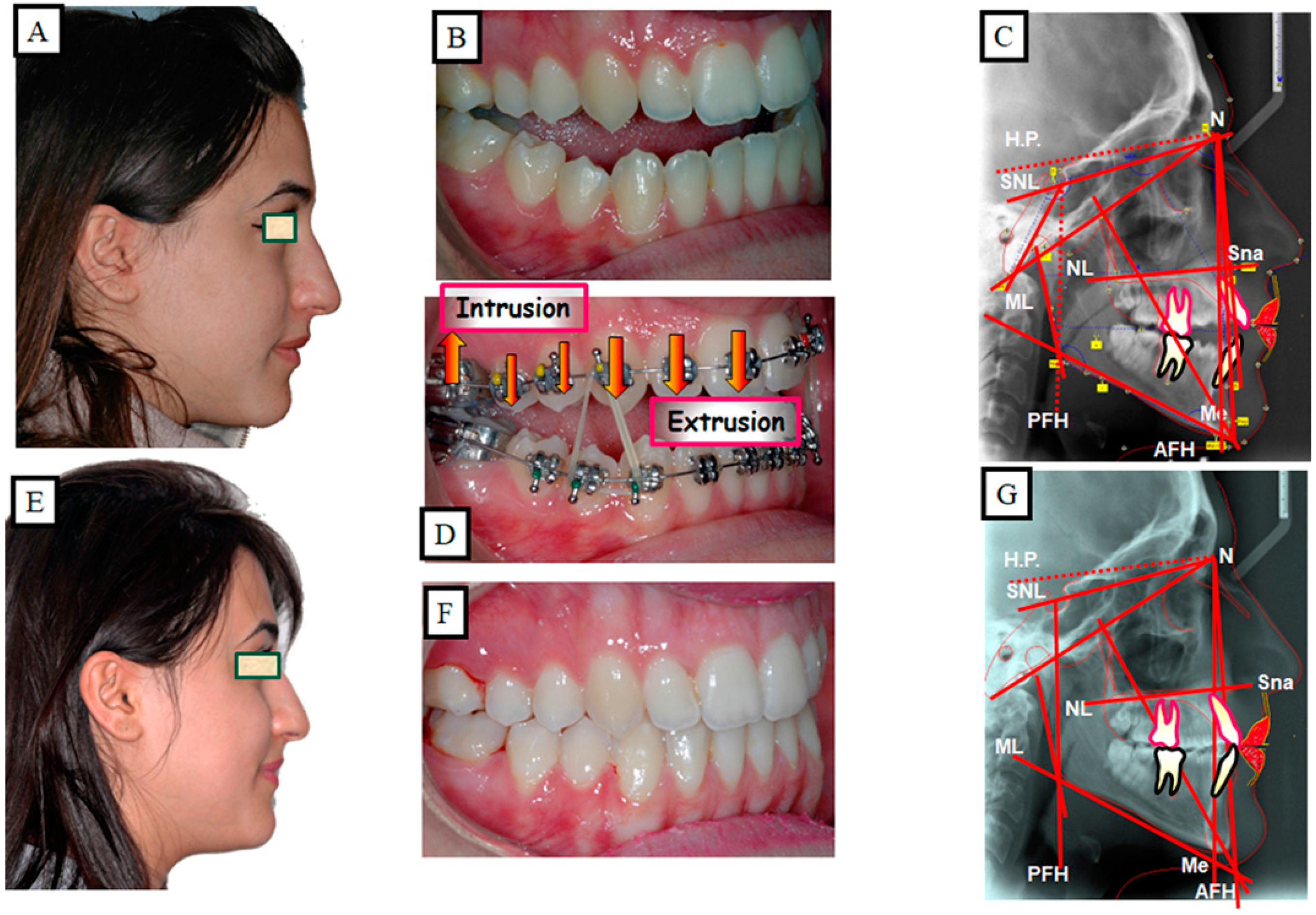 Jpm 13 01617 g017 Jpm 13 01617 g017