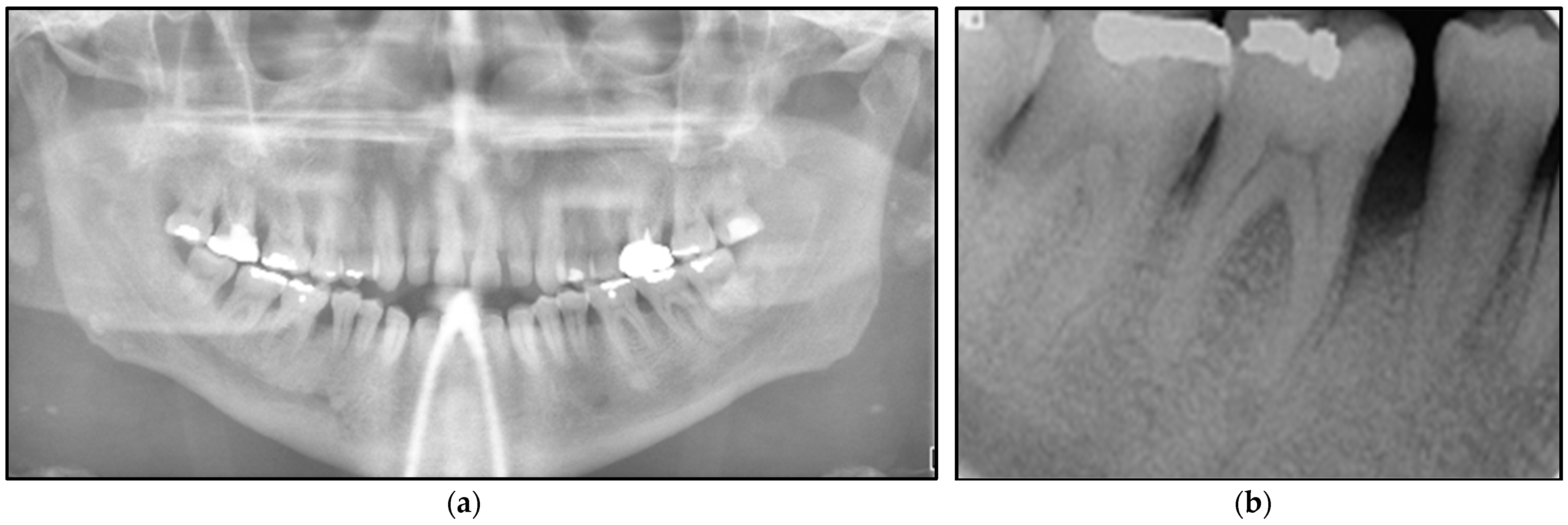 Jpm 14 00026 g003 Jpm 14 00026 g003