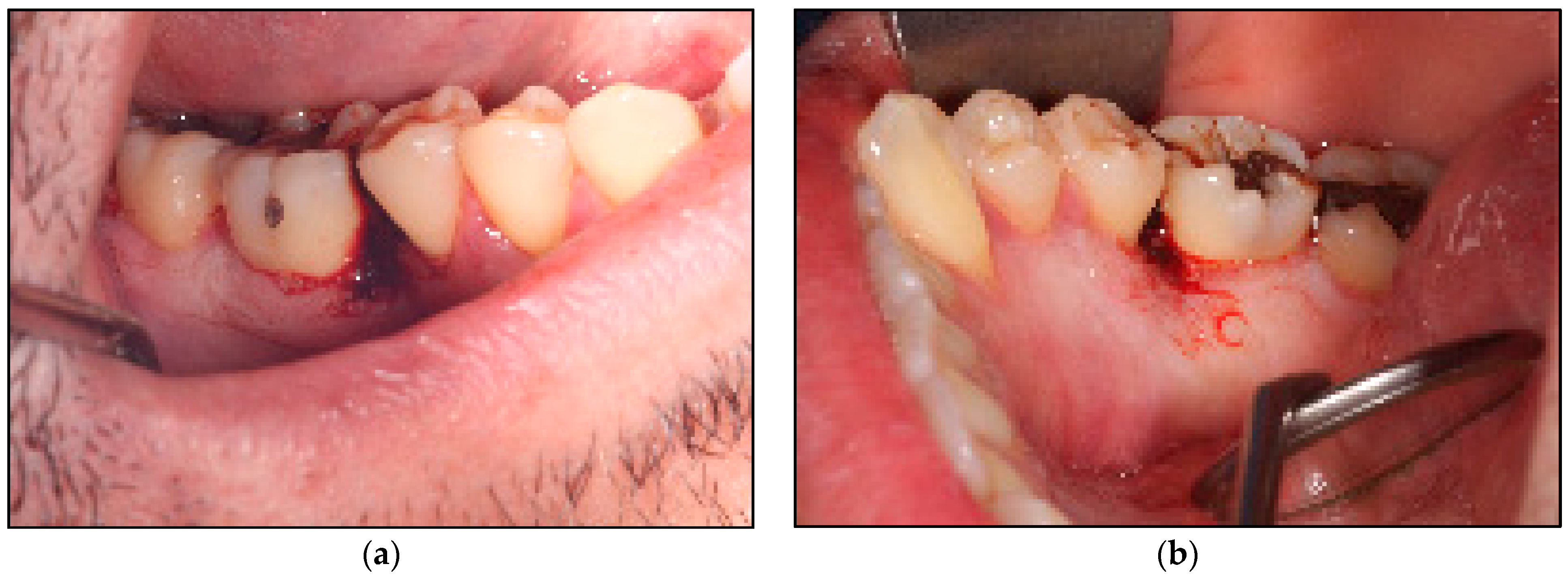 Jpm 14 00026 g005 Jpm 14 00026 g005