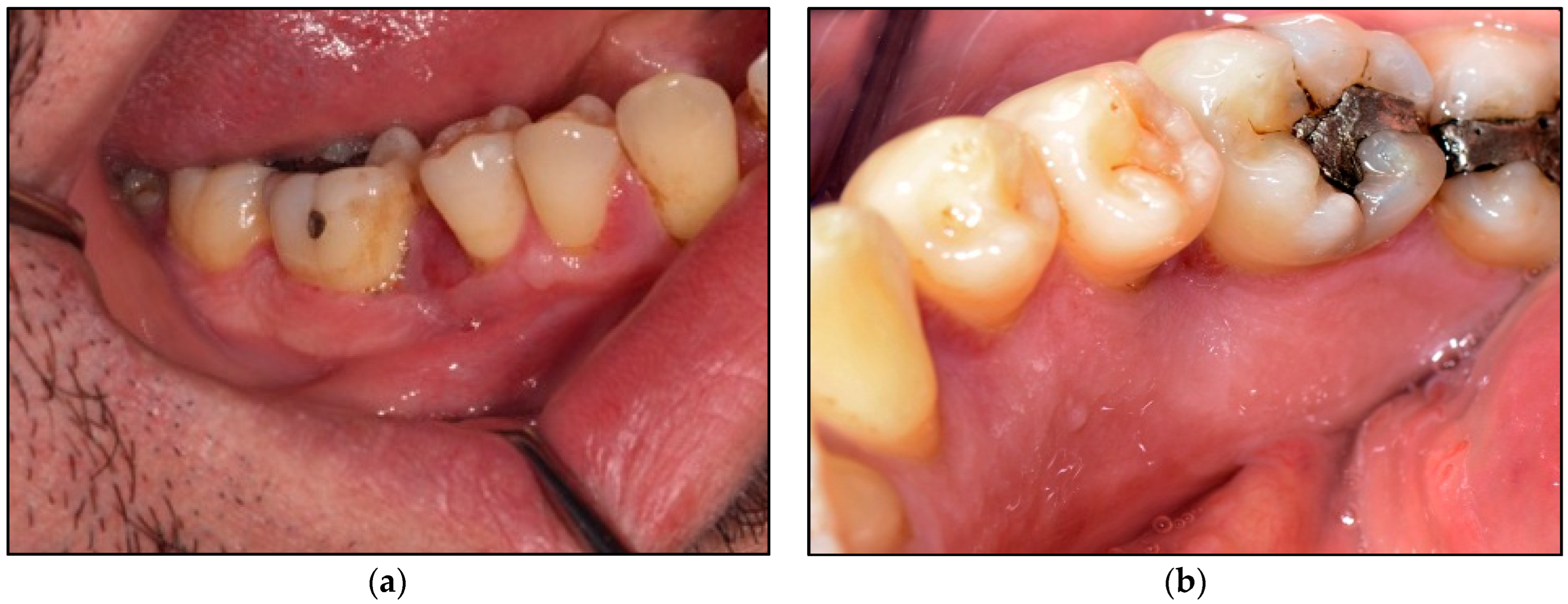 Jpm 14 00026 g006 Jpm 14 00026 g006