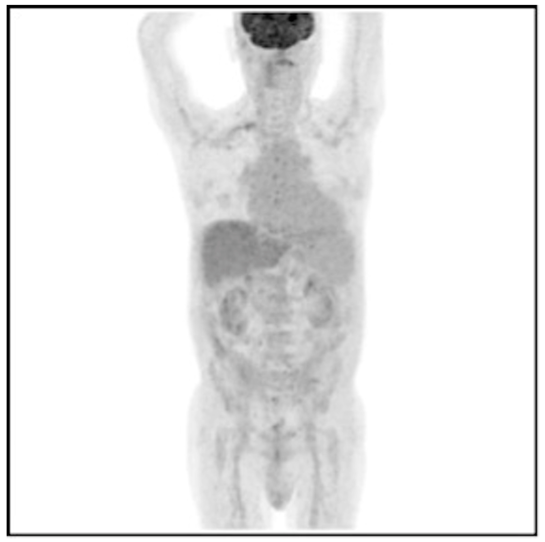 Jpm 14 00065 g003 Jpm 14 00065 g003