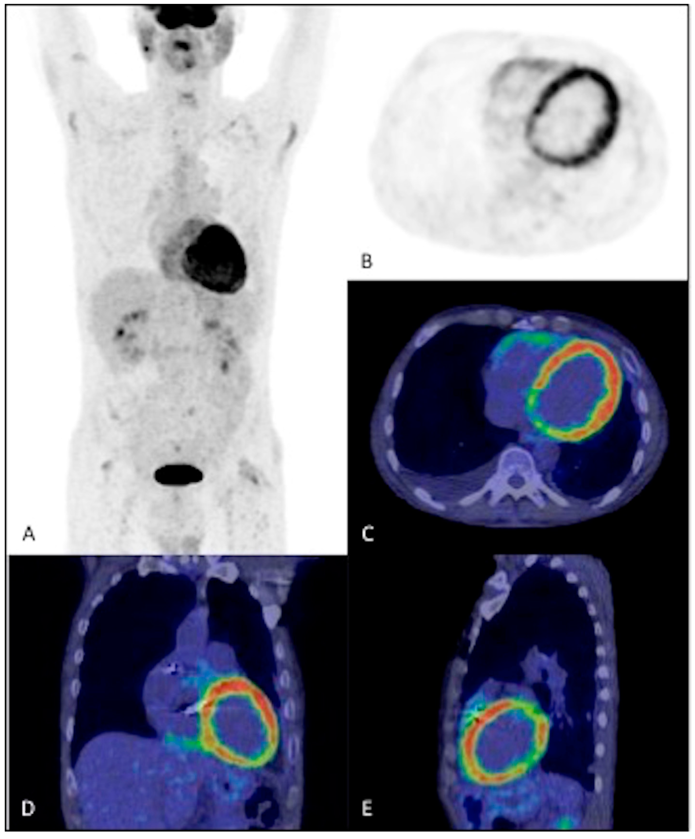 Jpm 14 00065 g007 Jpm 14 00065 g007