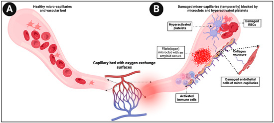 Possible Role of Fibrinaloid Microclots in Postural