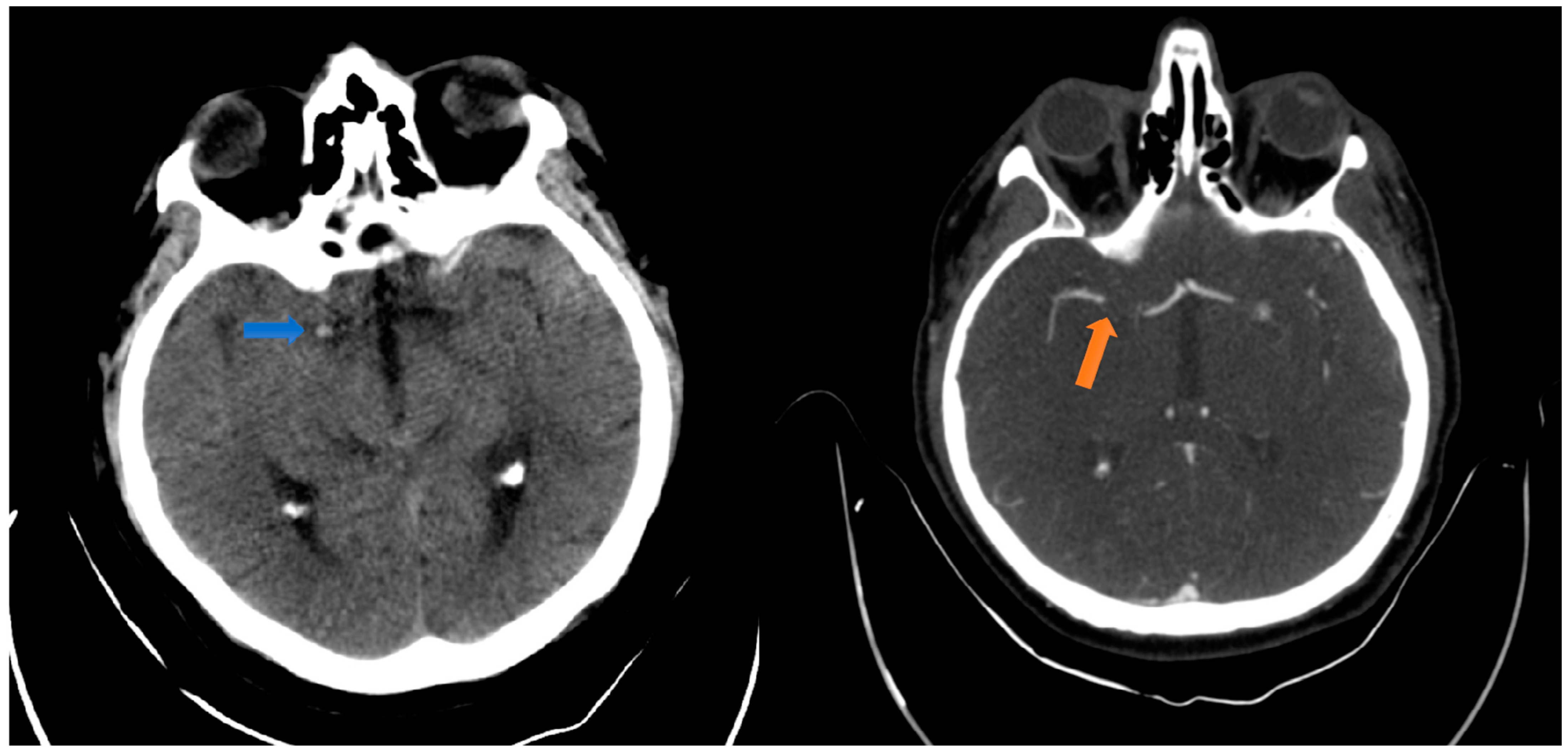 Jpm 14 00216 g001 Jpm 14 00216 g001