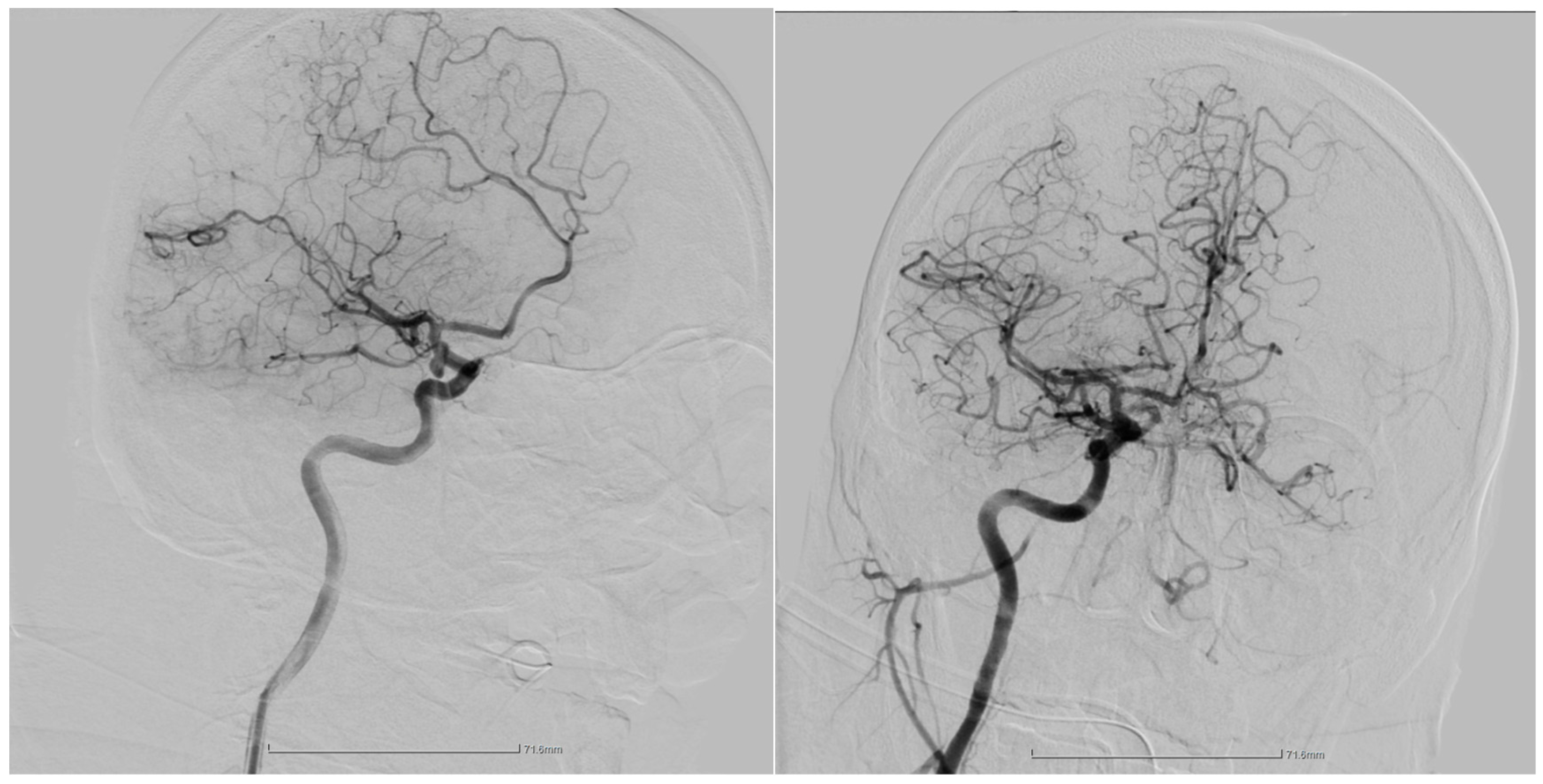 Jpm 14 00216 g002 Jpm 14 00216 g002