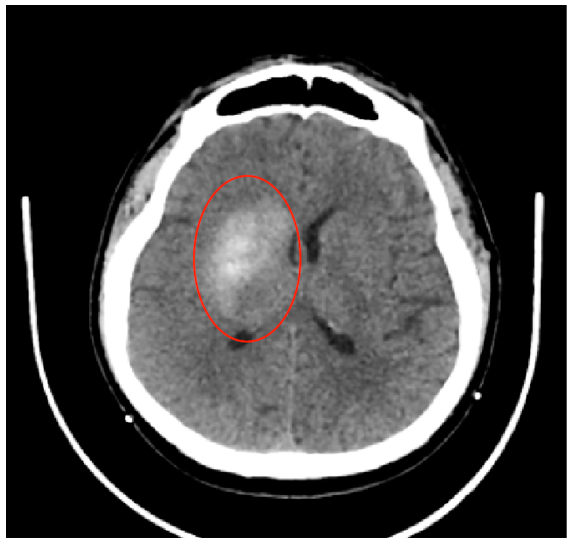 Jpm 14 00216 g003 Jpm 14 00216 g003