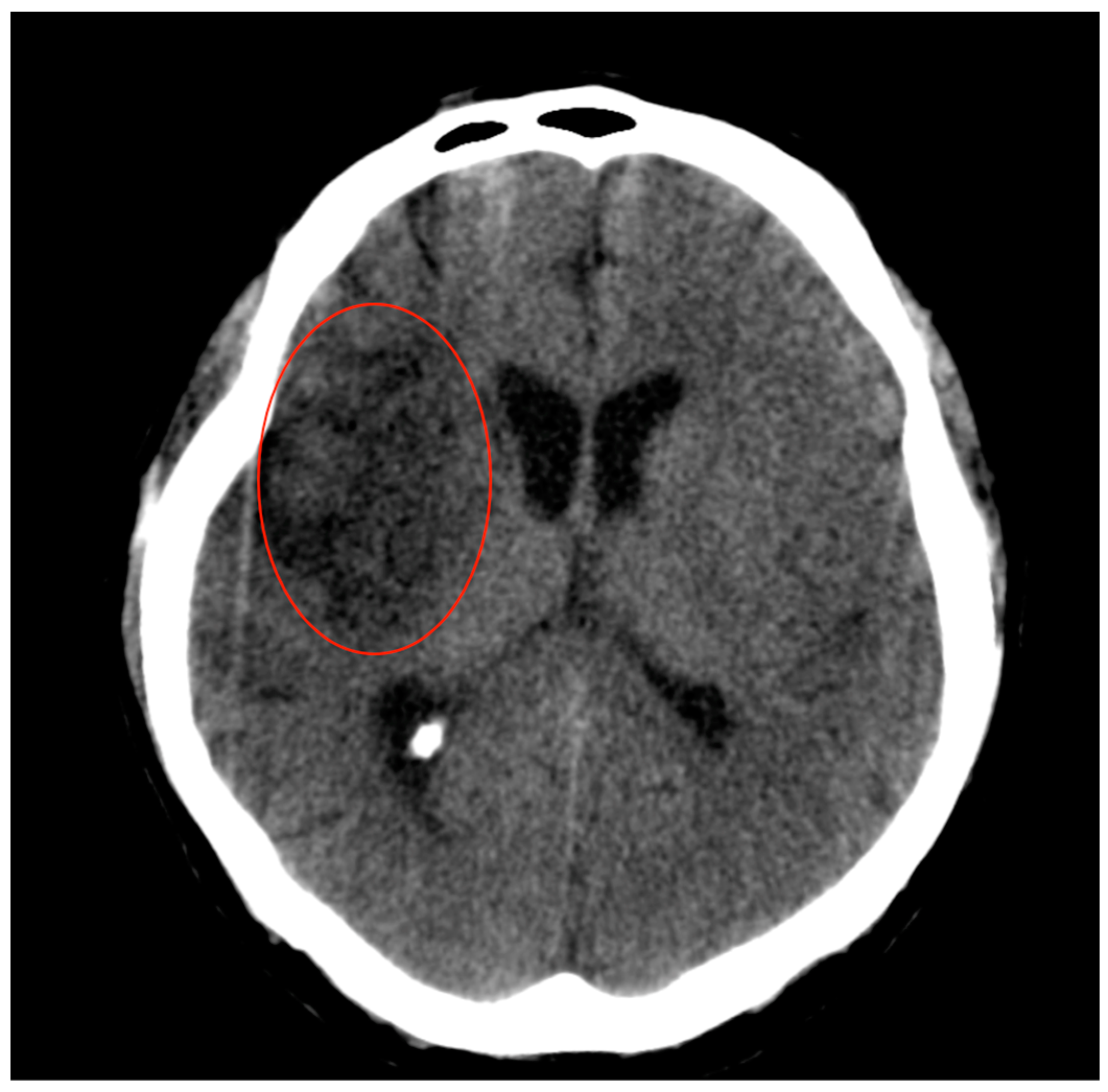 Jpm 14 00216 g004 Jpm 14 00216 g004