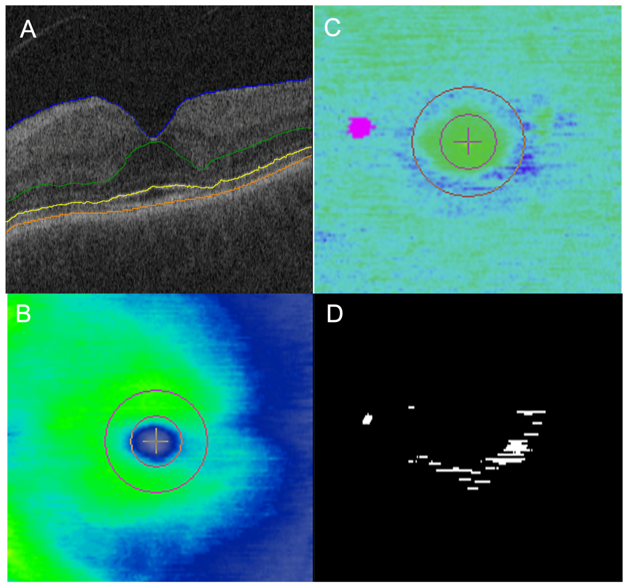Jpm 14 00448 g003 Jpm 14 00448 g003