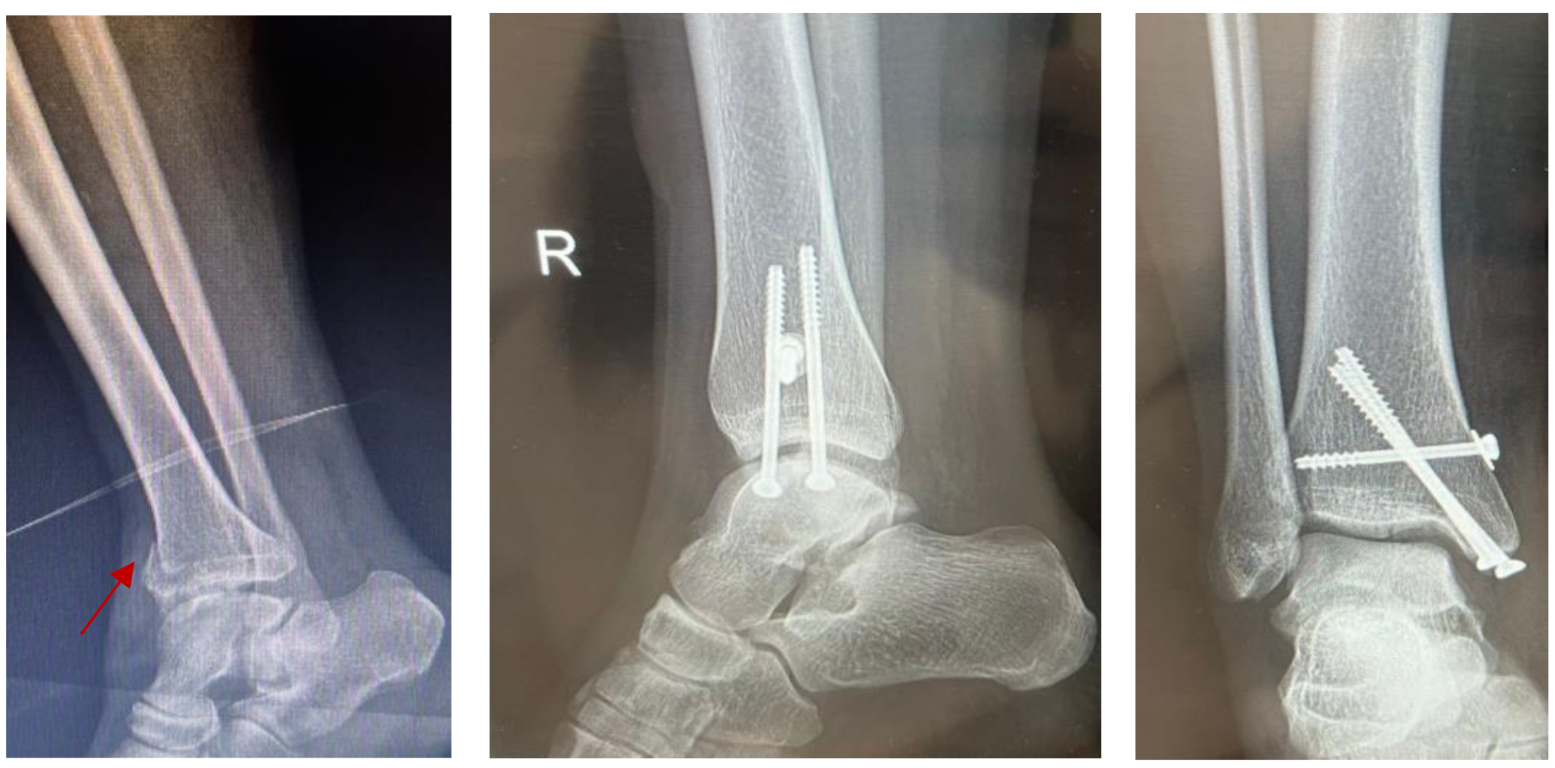 Jpm 14 00525 g004 Jpm 14 00525 g004