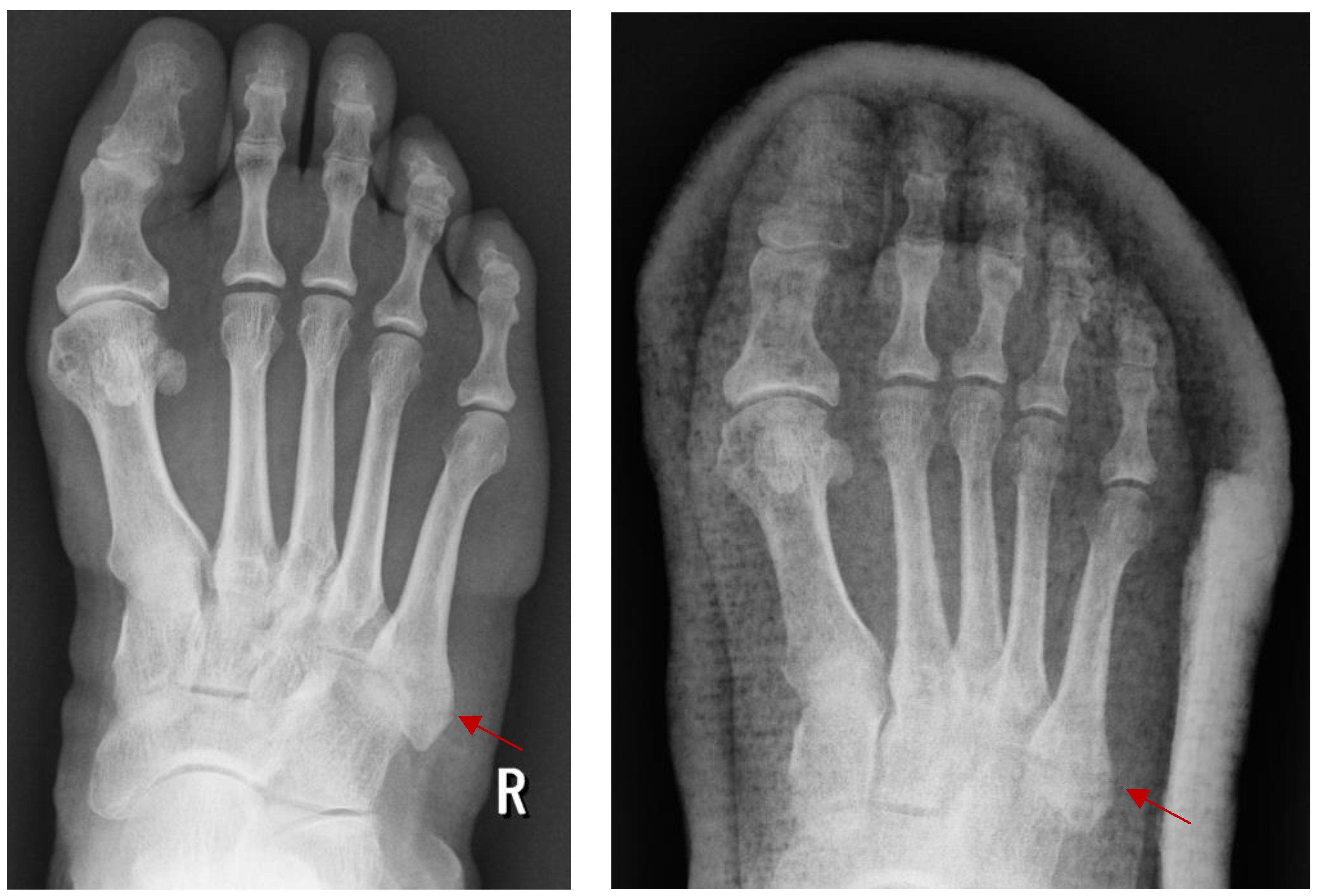 Jpm 14 00525 g005 Jpm 14 00525 g005