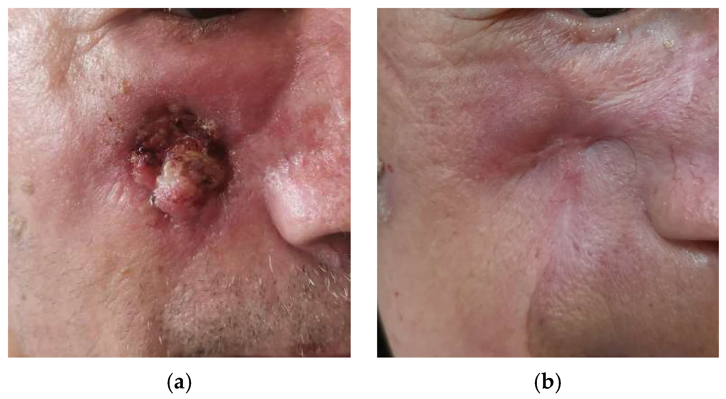 咬合治療ナビゲーション = How to treat patient with… The Immunomodulatory Potential of Concurrent High-Dose