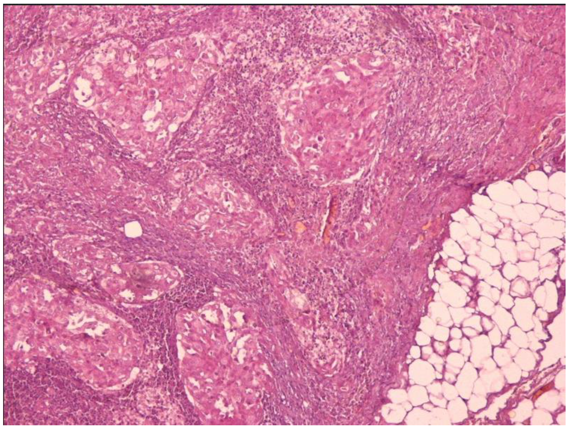 雑誌 - Thyroid Cancer Explore | メディカルレビュー社 書籍