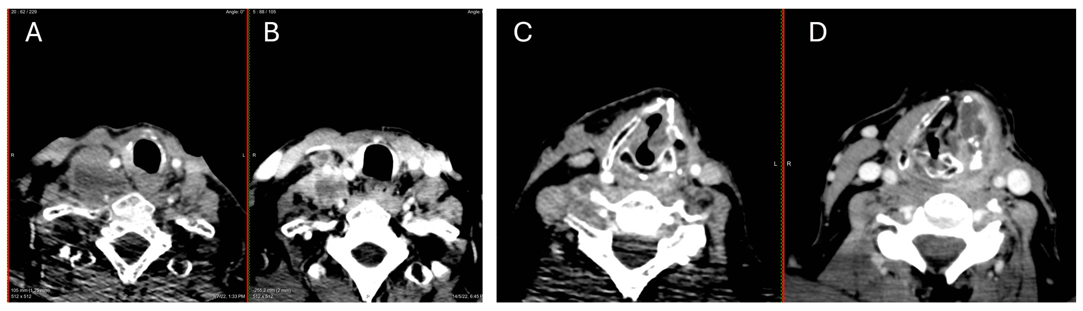 Jpm 14 00654 g003 Jpm 14 00654 g003