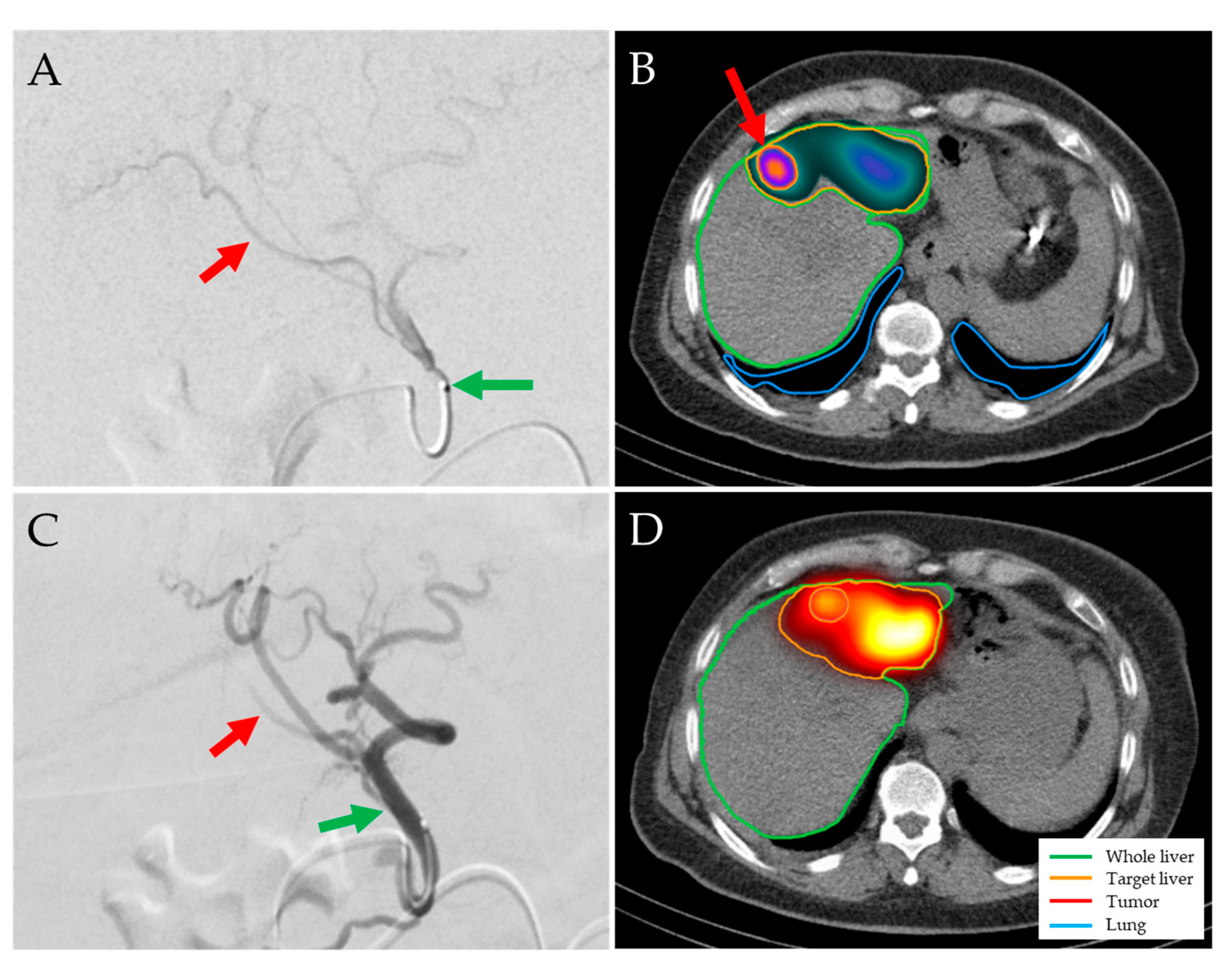 Jpm 14 00747 g003 Jpm 14 00747 g003