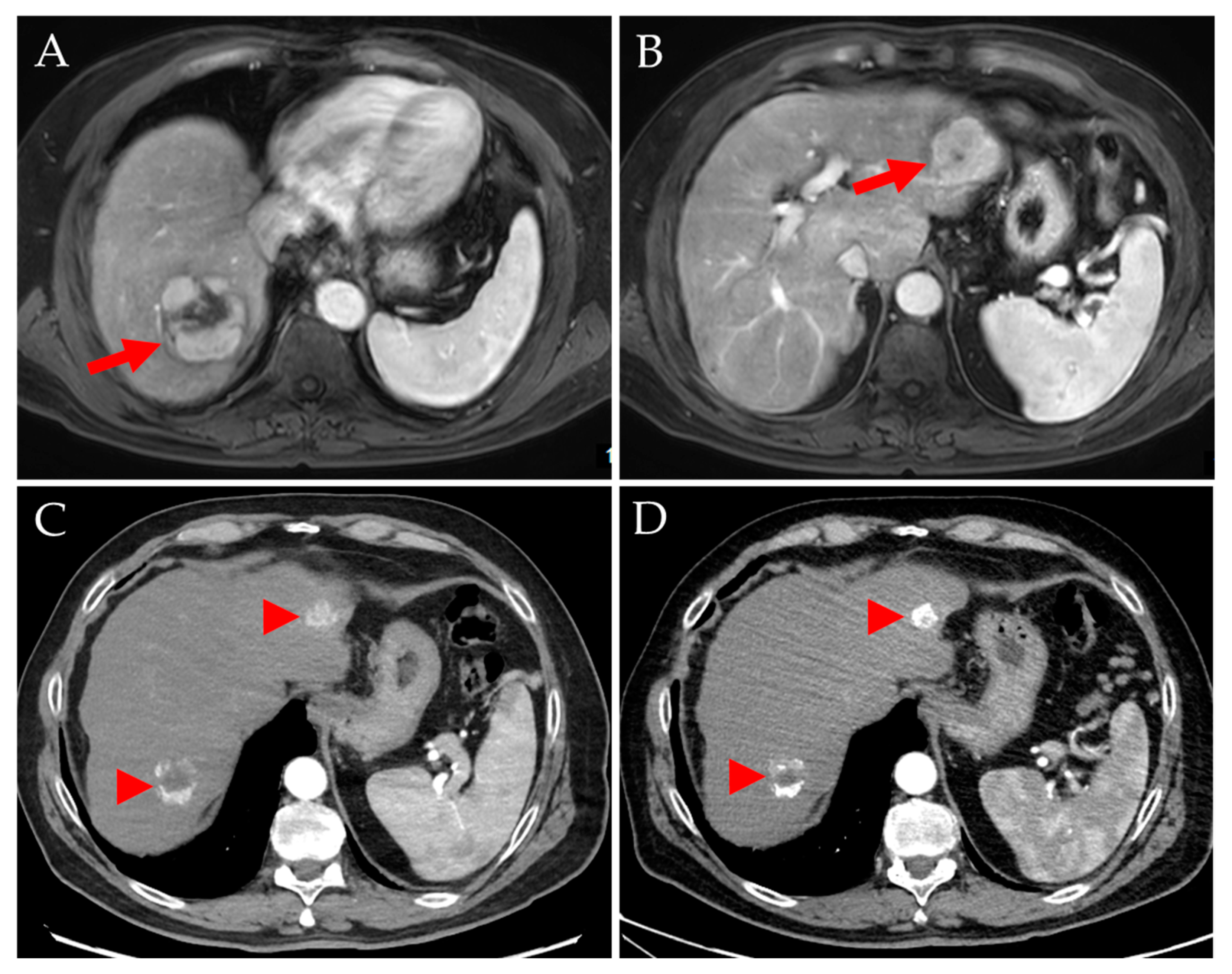 Jpm 14 00747 g005 Jpm 14 00747 g005