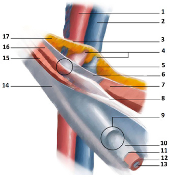 Anatomical Features in Inguinal-Pubic-Adductor Area That May Contribute to  Gender Difference in Susceptibility to Groin Pain Syndrome