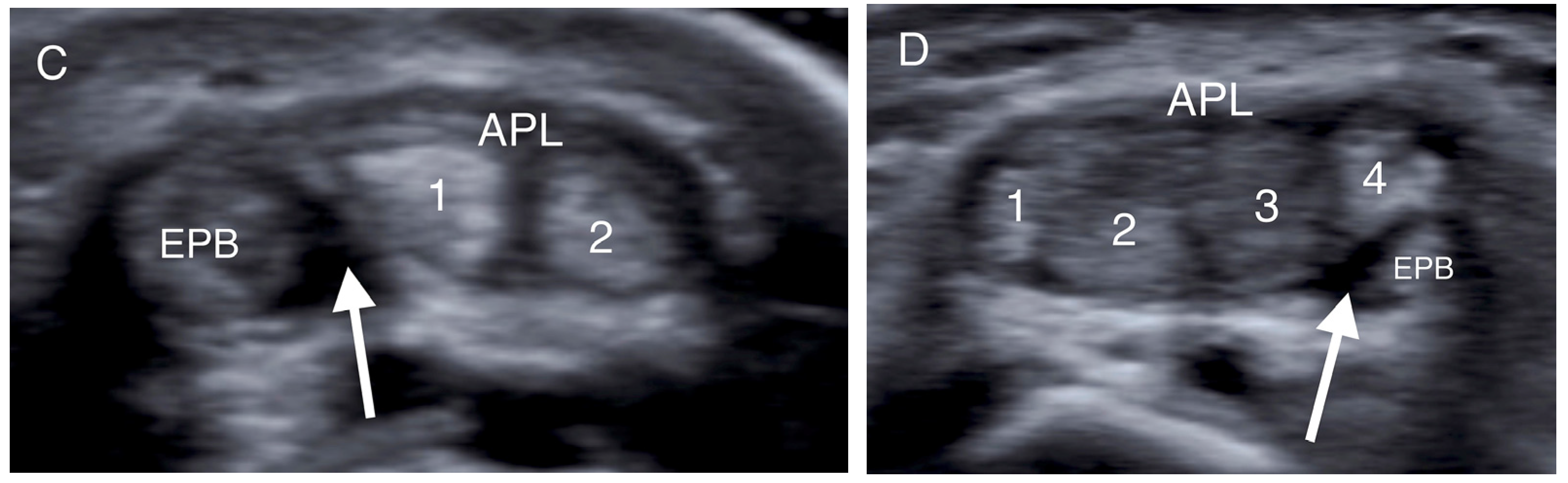 Jpm 14 00928 g002b Jpm 14 00928 g002b