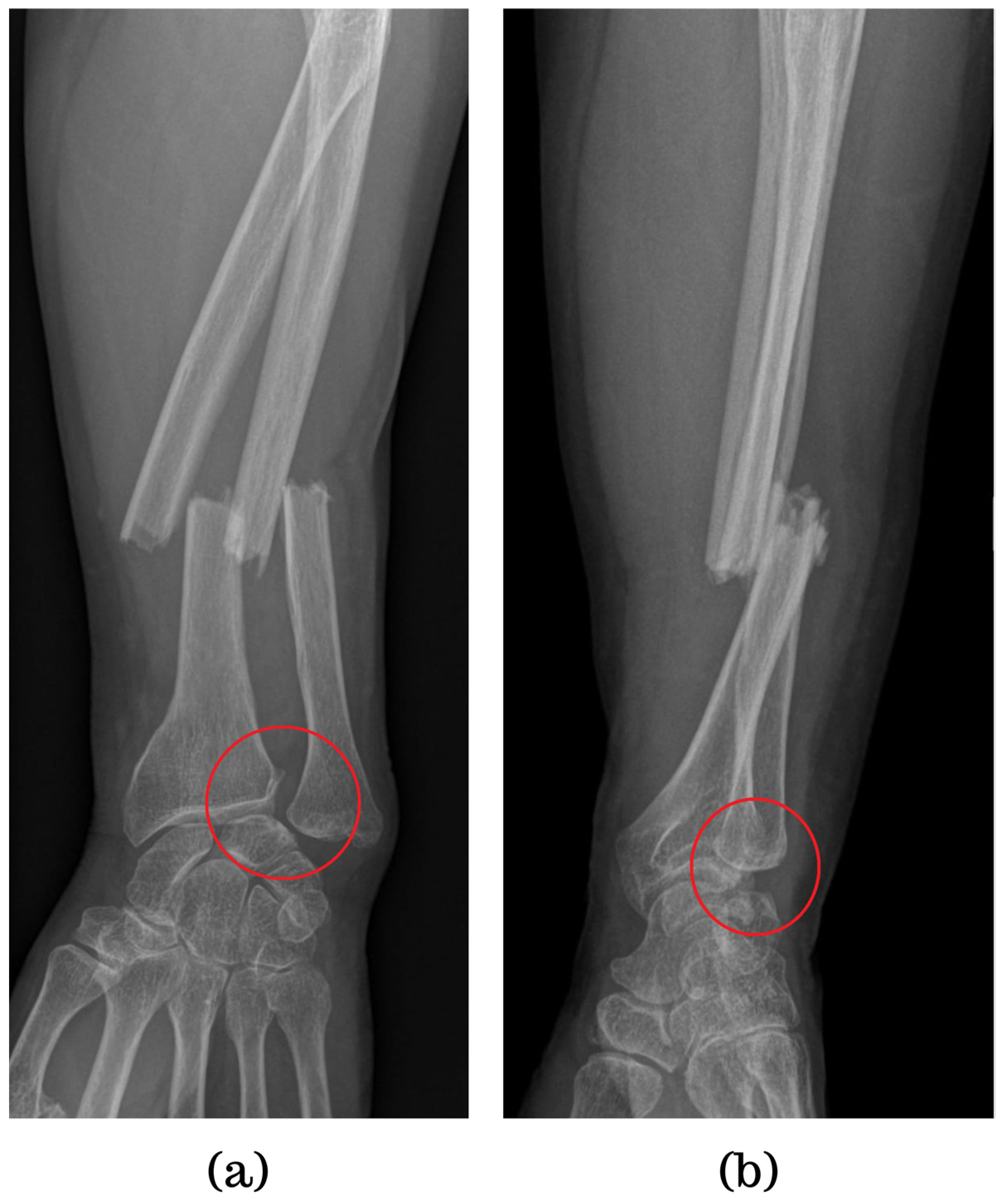 Jpm 14 00943 g002 Jpm 14 00943 g002