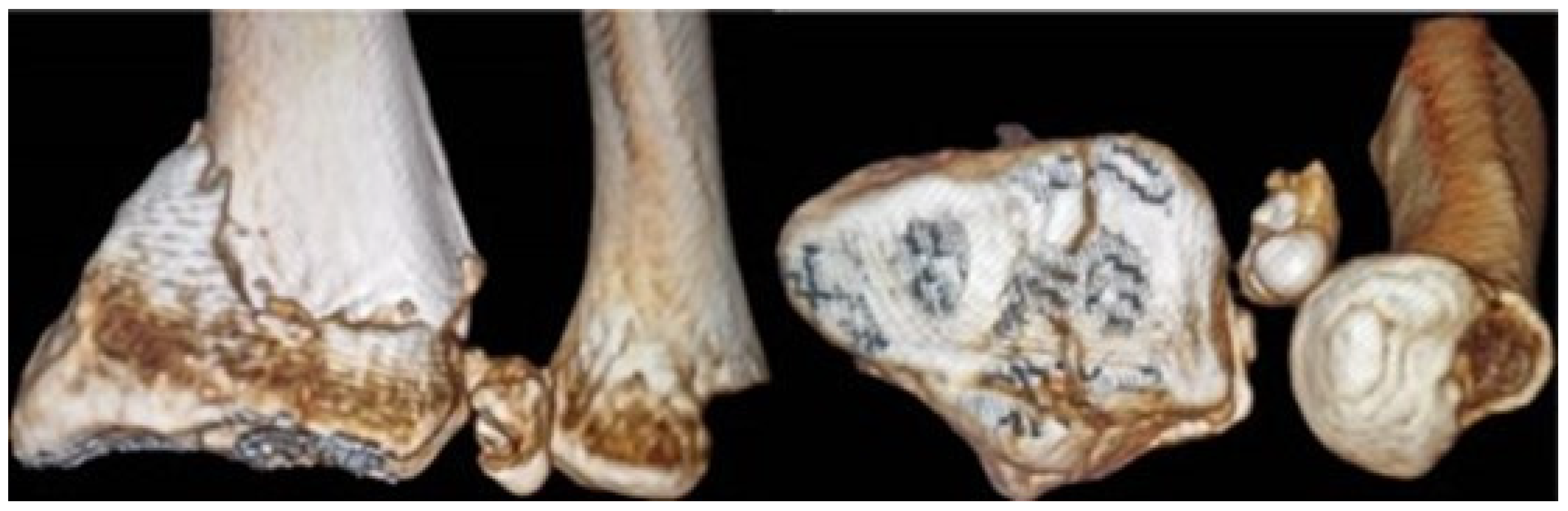 Jpm 14 00943 g004 Jpm 14 00943 g004