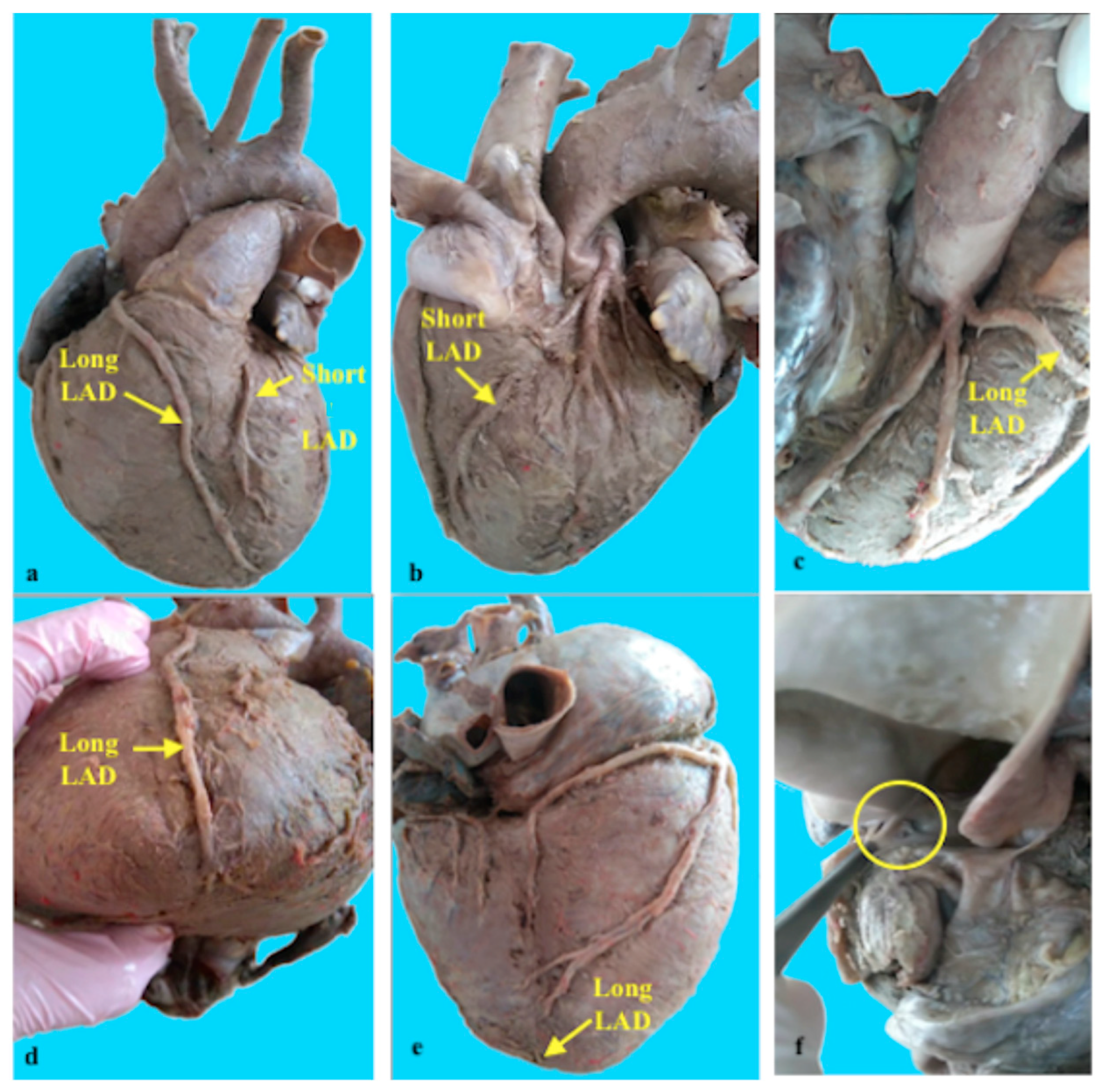 Jpm 14 01007 g002 Jpm 14 01007 g002
